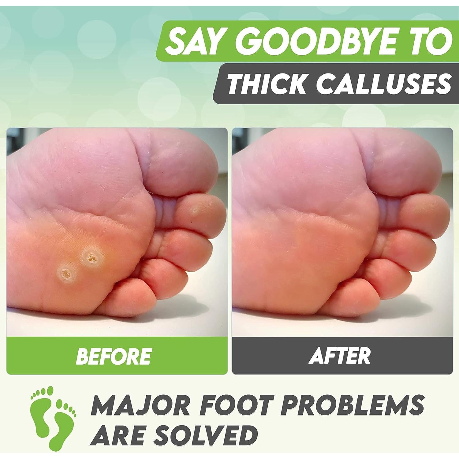 Mascarilla Exfoliante para Pies Karma Organic - Té Verde Hidratante, 2 Unidades