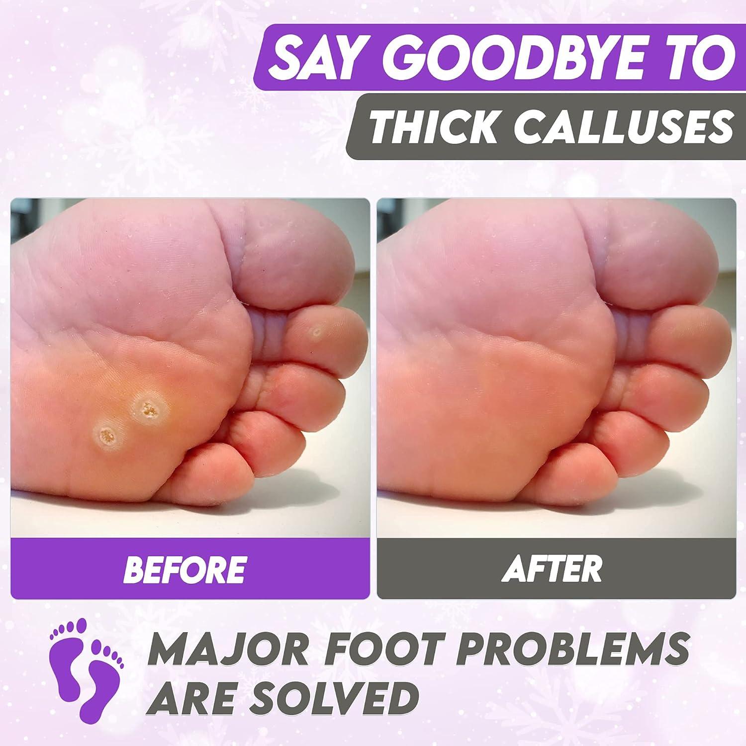 Mascarilla Exfoliante para Pies Karma Organic con Lavanda - Hidratante y Reparadora (Paquete de 2)