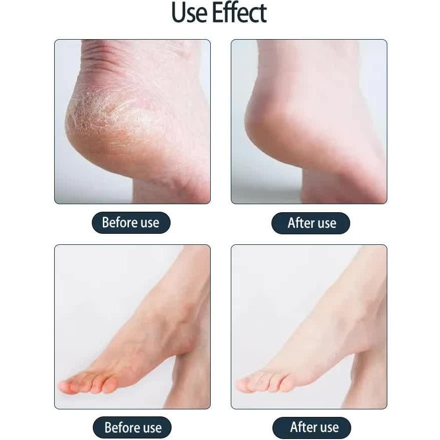 Mascarilla Hidratante para Pies Skailie - 1 Par, Hidratación Intensiva