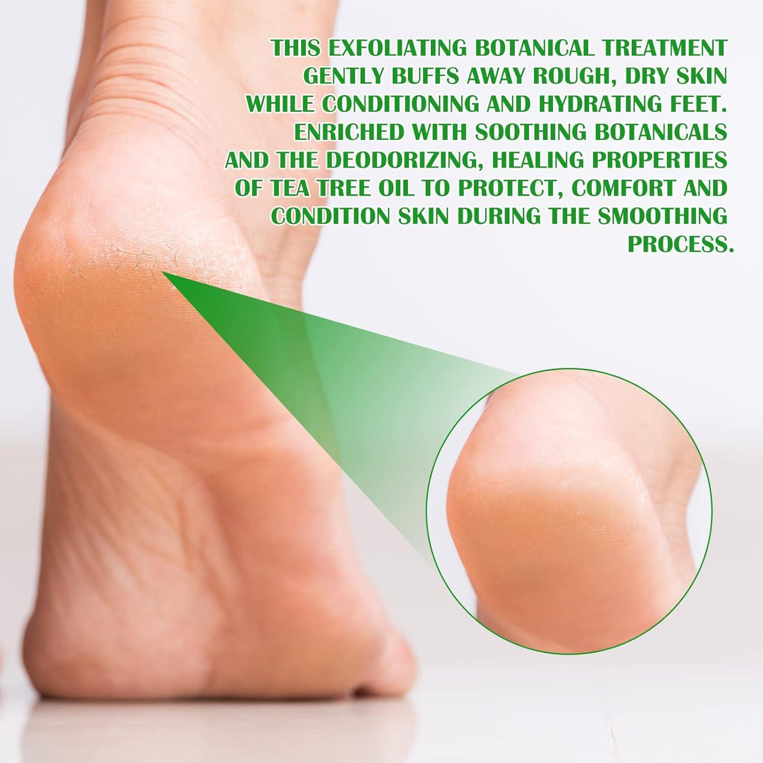 Spray Exfoliante Hidratante para Pies Xintourong 100ml