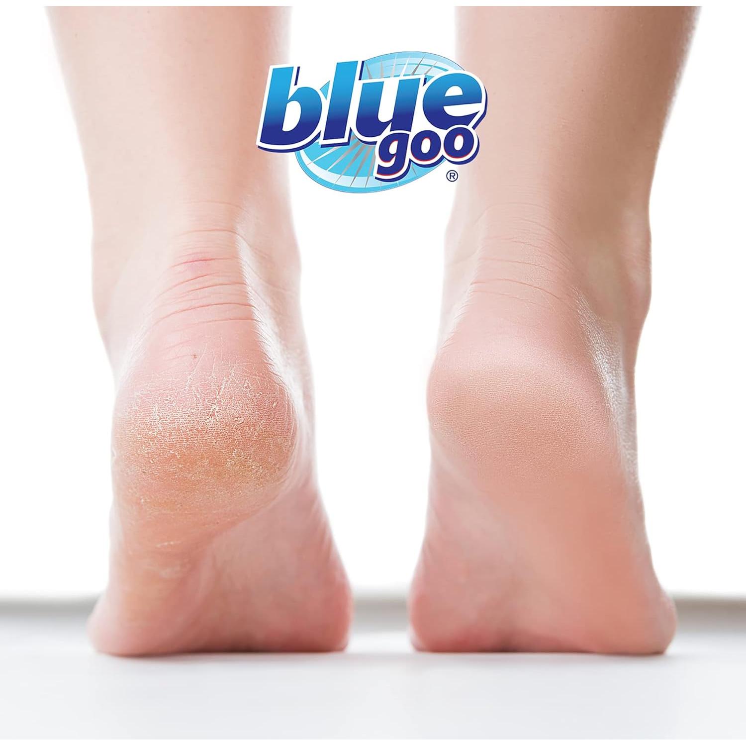 Acondicionador de Piel Blue Goo 60ml para Talones y Manos Secas