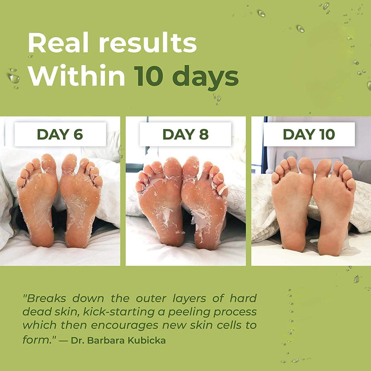 Mascarilla Exfoliante para Pies C Rejuvenate 150g