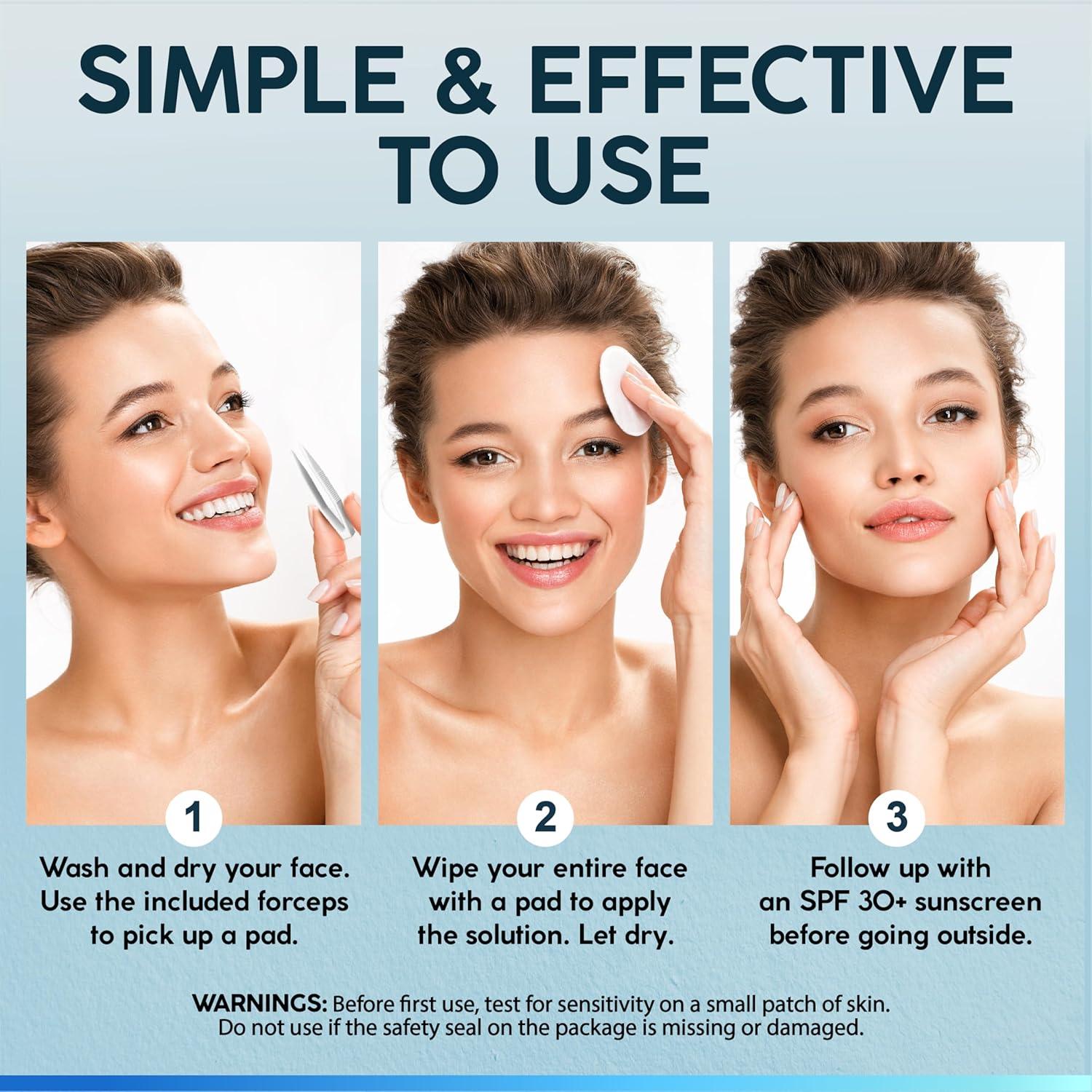 Almohadillas Exfoliantes Nuvadermis 35% Ácido Glicólico - 60 Unidades