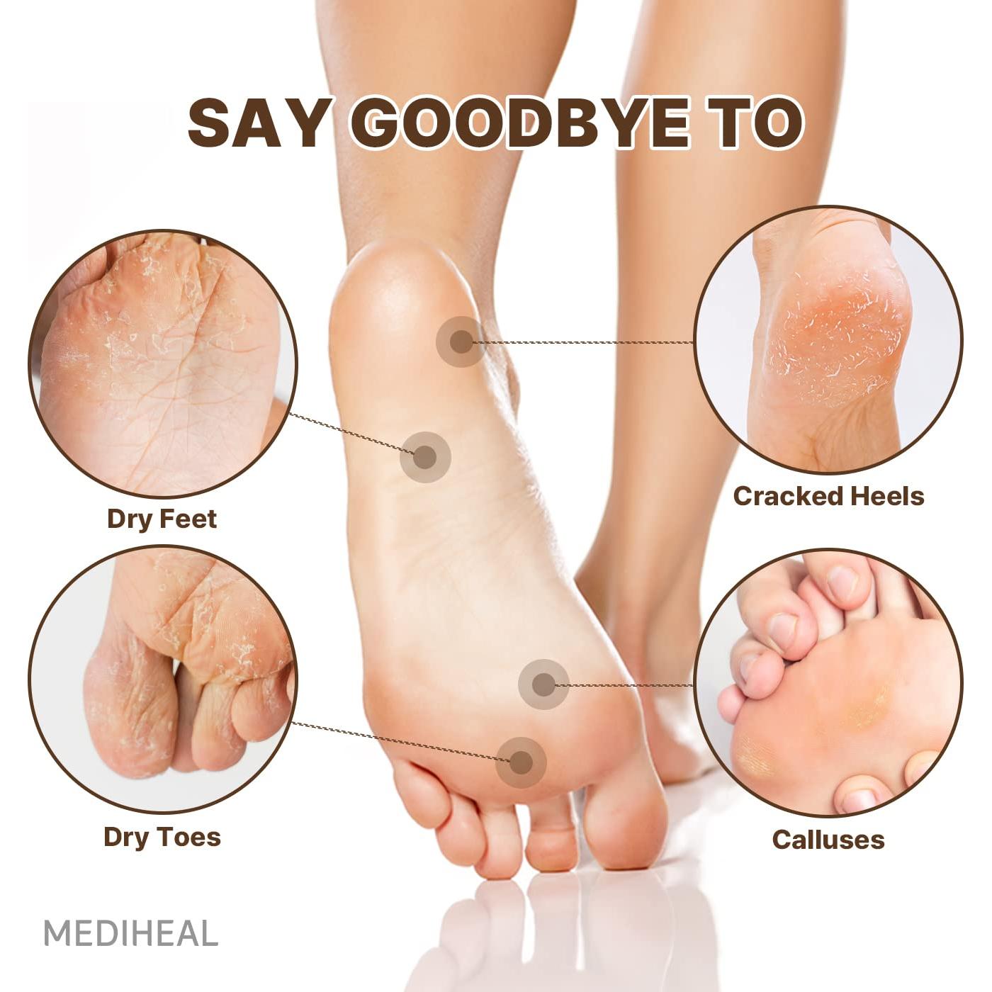 Mascarilla para Pies MEDIHEAL 5 Unidades Hidratante Ceramidas