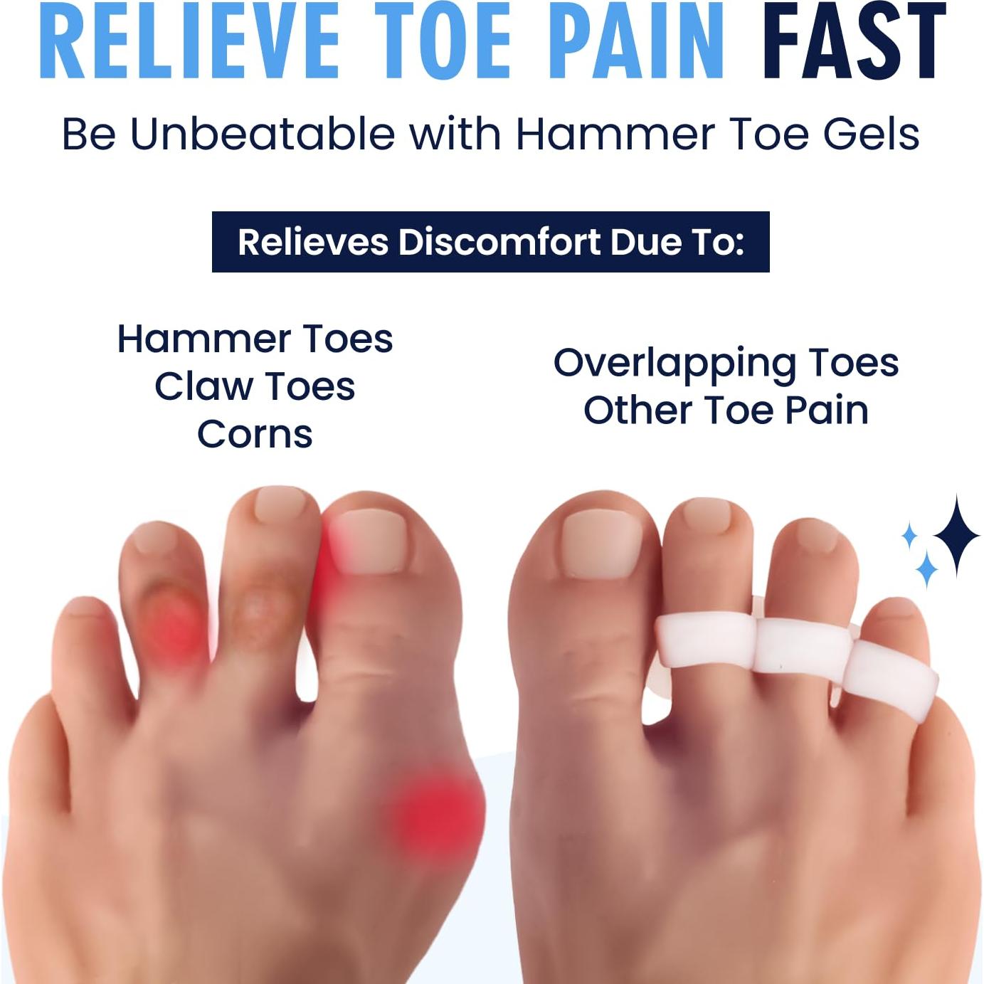 Geles para Dedos en Martillo Dr. Frederick - 2 Pares - Alivio Todo el Día