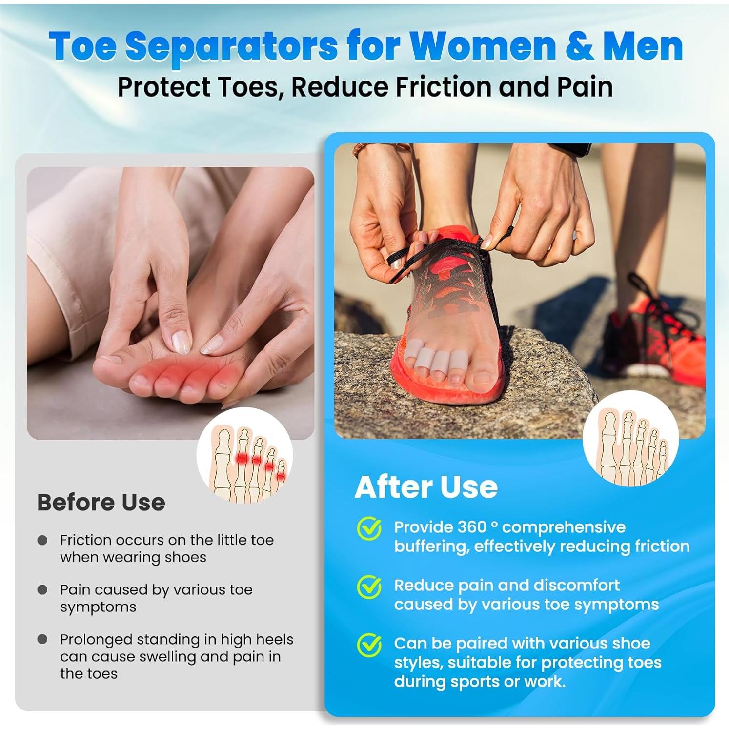 Protectores de Dedos de Gel Pnrskter - 20 Piezas para Alivio del Dolor