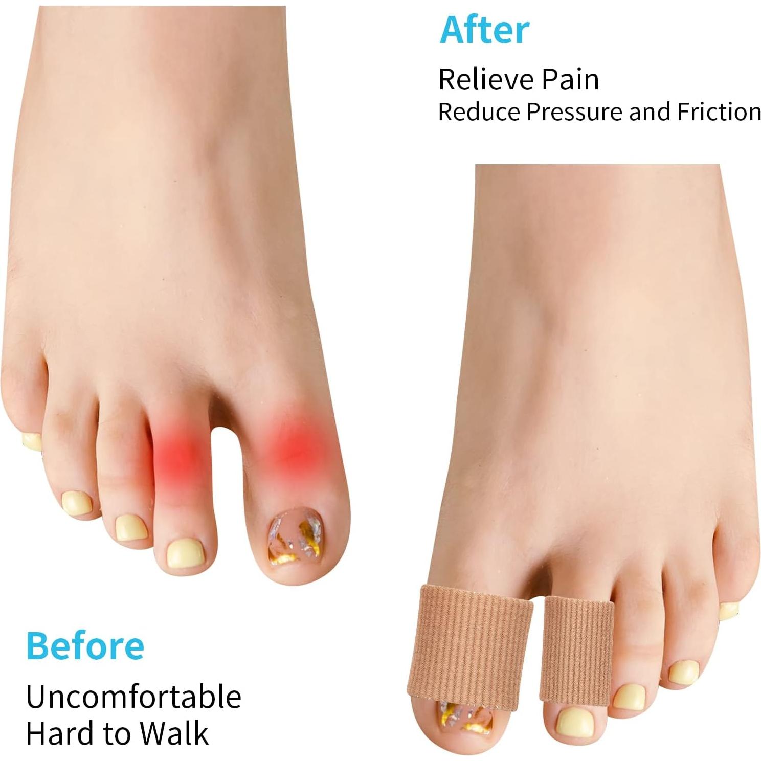 Protectores de Dedos de Gel Tifanso 24 Piezas para Ampollas