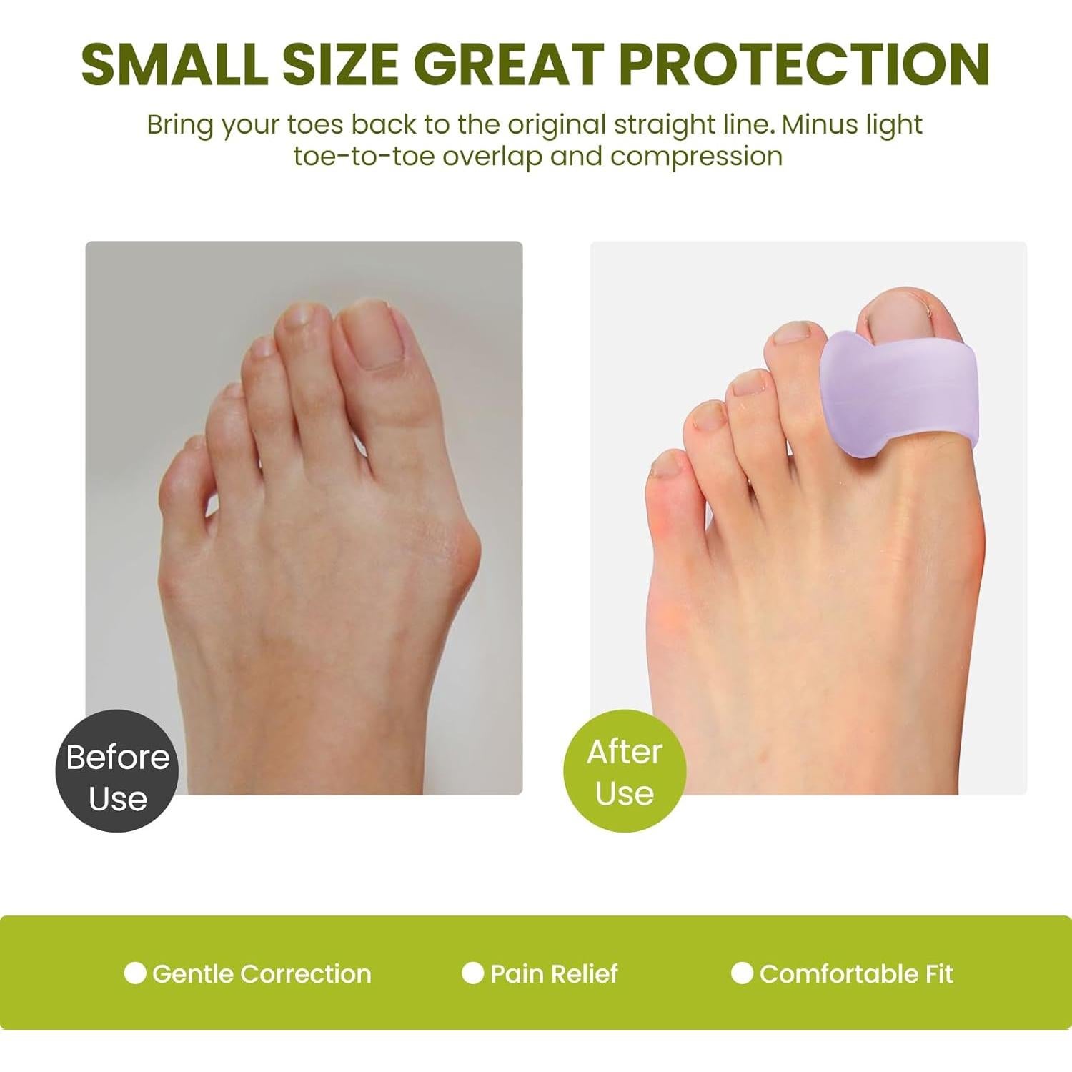 Separador de Dedos Bukihome para Juanetes - Paquete de 6