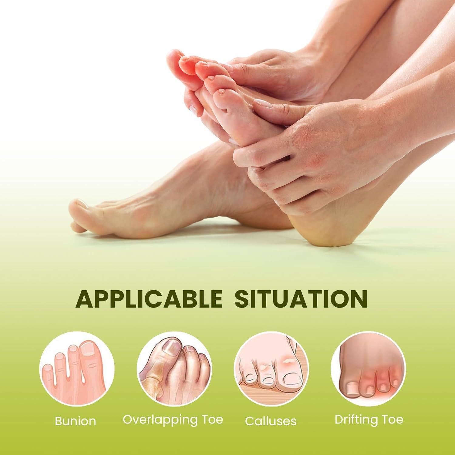 Separador de Dedos Bukihome para Juanetes - Paquete de 6