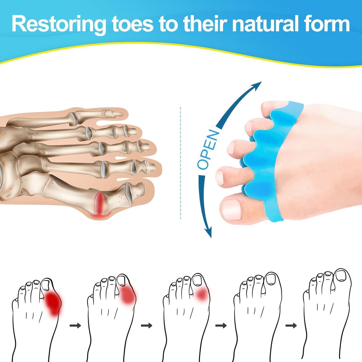 Separadores de Dedos Juzure 8 PCS Silicona Correctores Juanetes