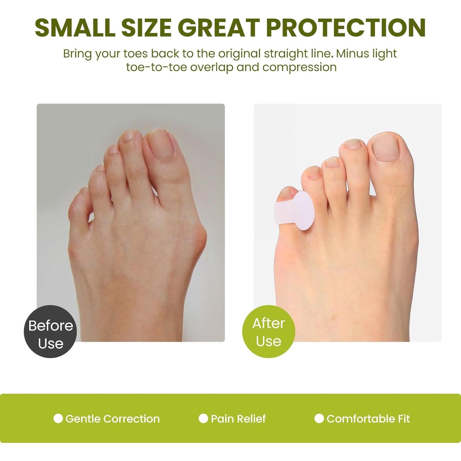 Separadores de Dedos de Silicona Bukihome - Paquete de 10 para Alivio de Juanetes y Dedos Superpuestos - Tamaño Meñique