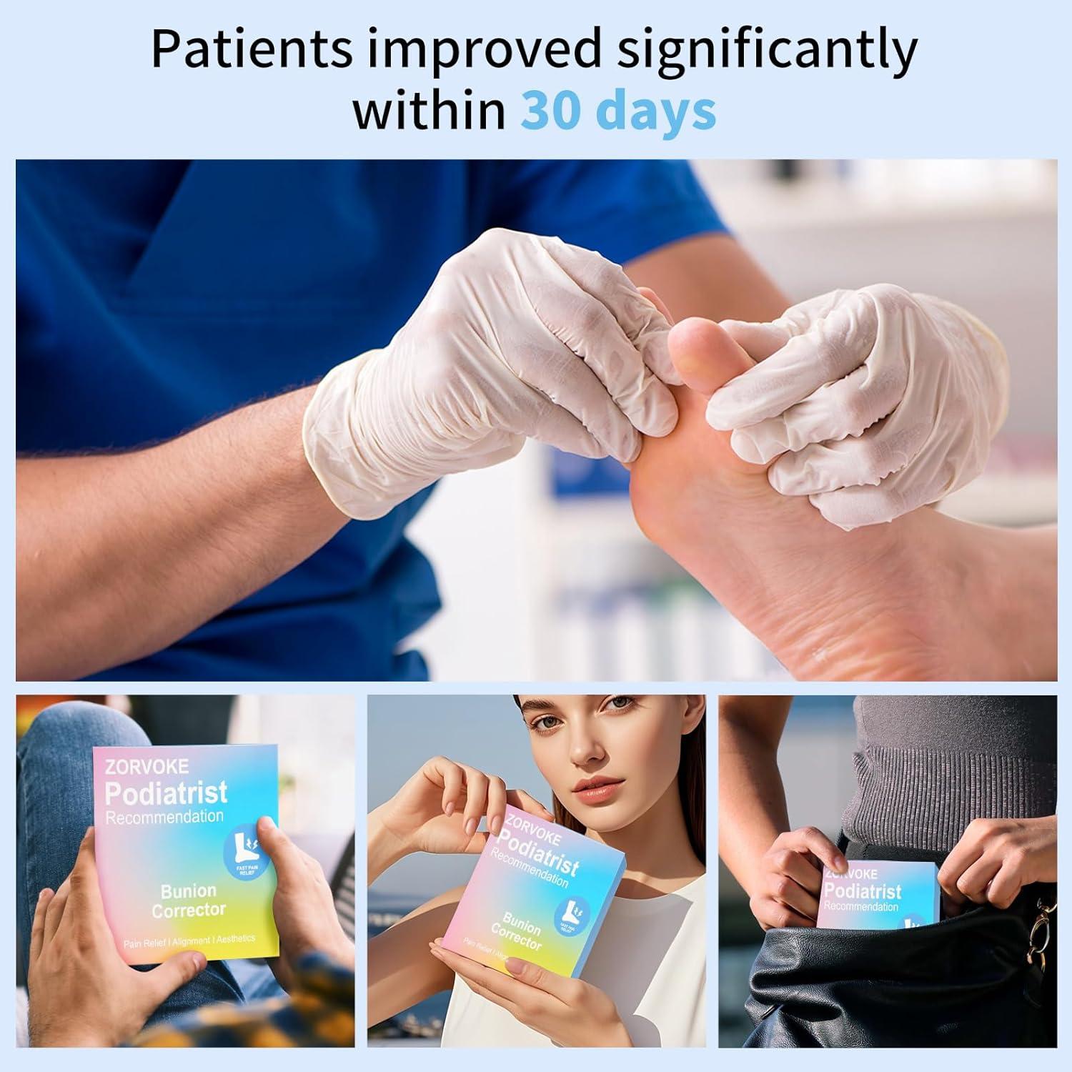 Corrector de juanetes ZORVOKE para hombres y mujeres - Alivio del dolor - 2 piezas beige