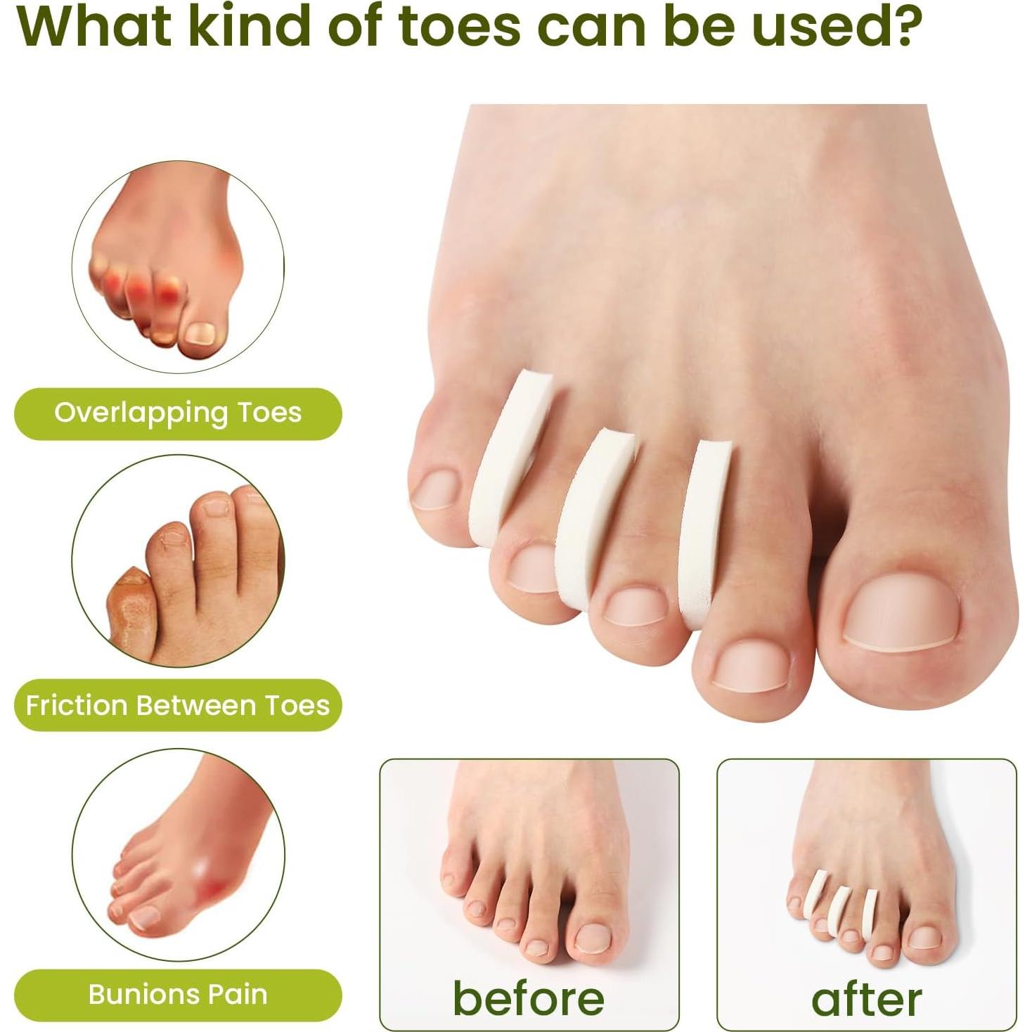 Separadores de Dedos de Espuma Bukihome - 100 Piezas, Alivio del Dolor