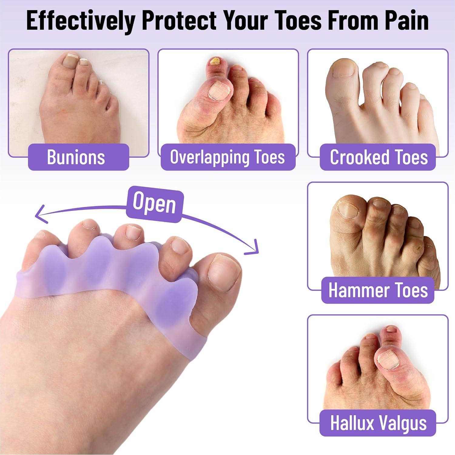 Separadores de Dedos de Gel Dr. JK ToePal - 2 Pares, Correctores de Juanete