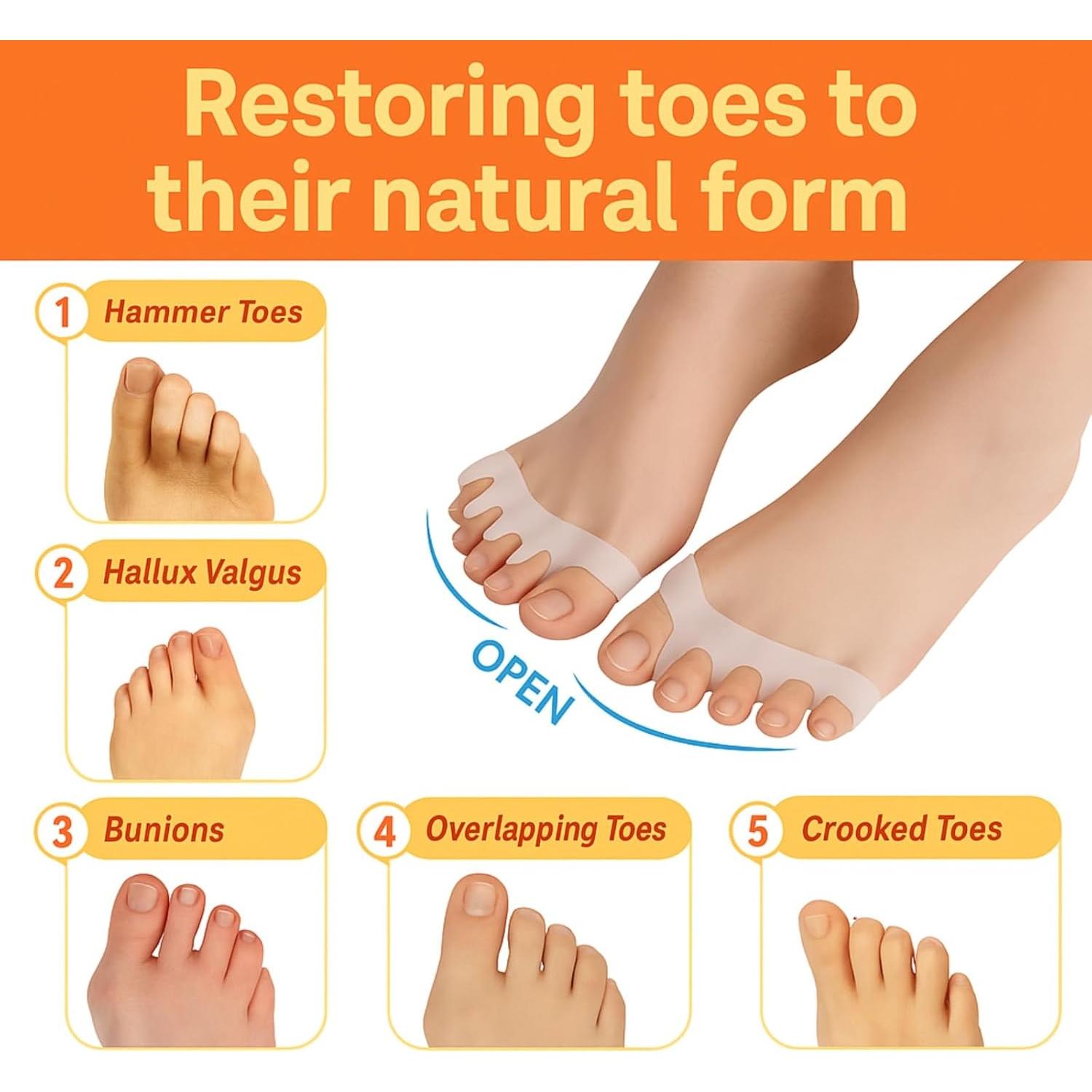 Separadores de Dedos de Gel para Pies - Alivio de Juanetes y Dedos Superpuestos - Unisex