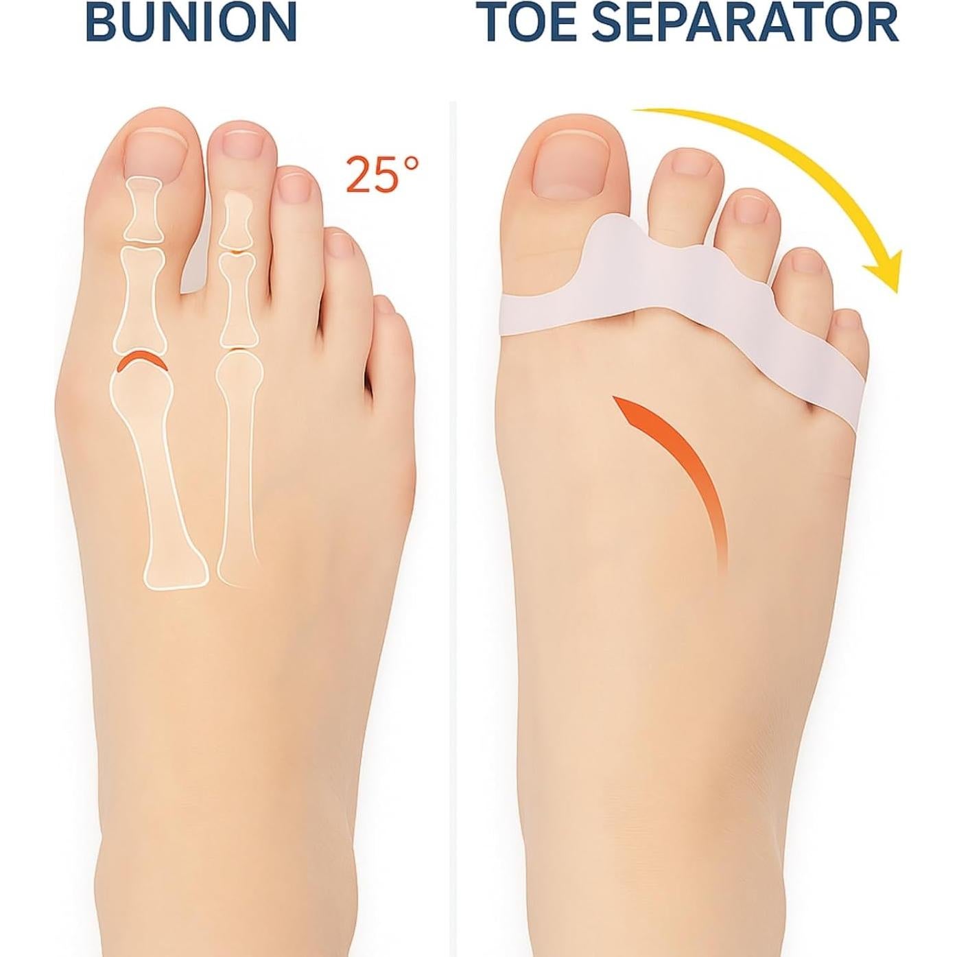 Separadores de Dedos de Gel para Pies - Alivio de Juanetes y Dedos Superpuestos - Unisex