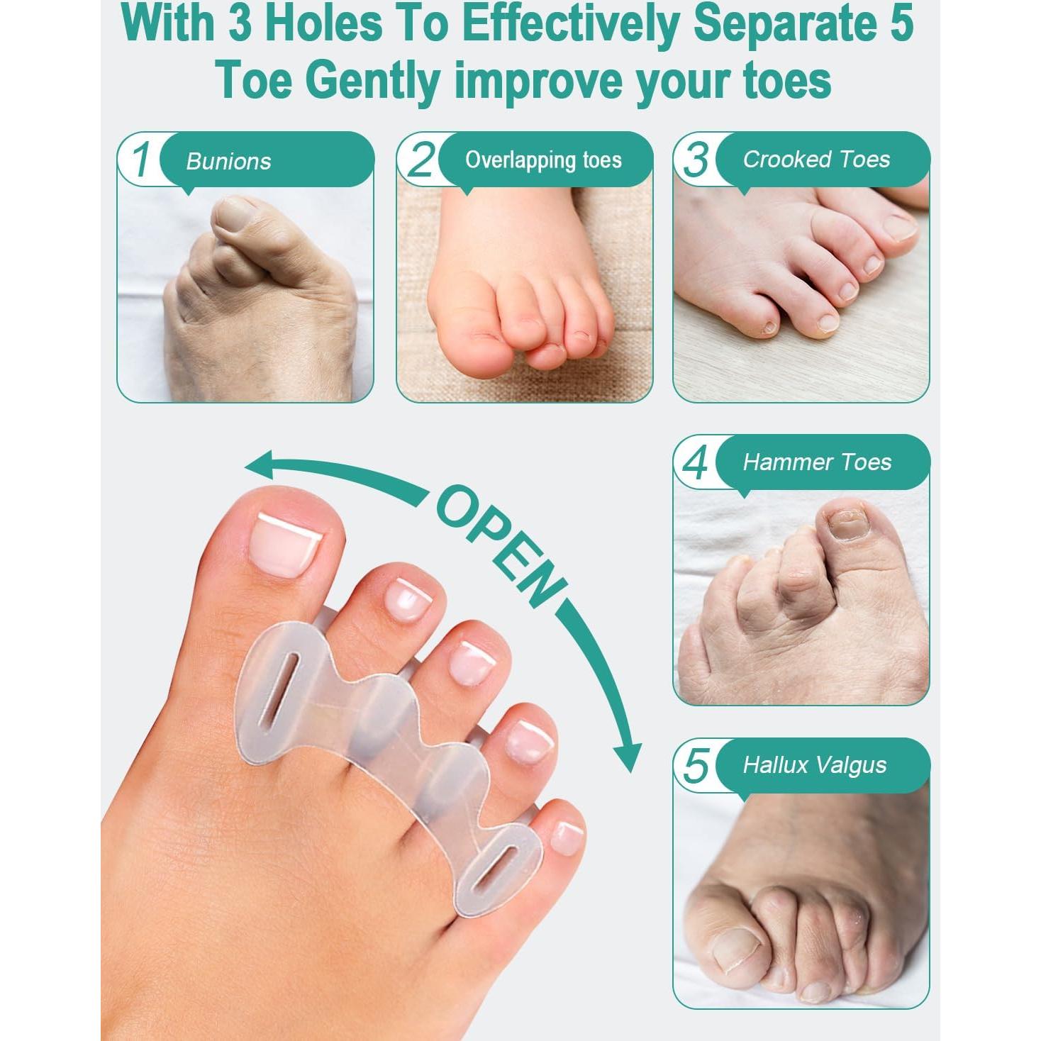 Separadores de Dedos de Silicona BLATOWN - 2 Pairs para Alivio de Juanetes