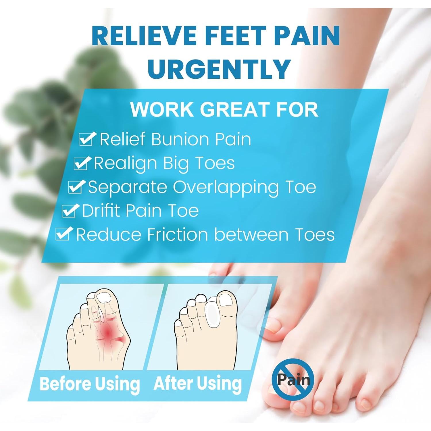 Separadores de Dedos de Silicona Happiby para Juanetes - 10 Piezas