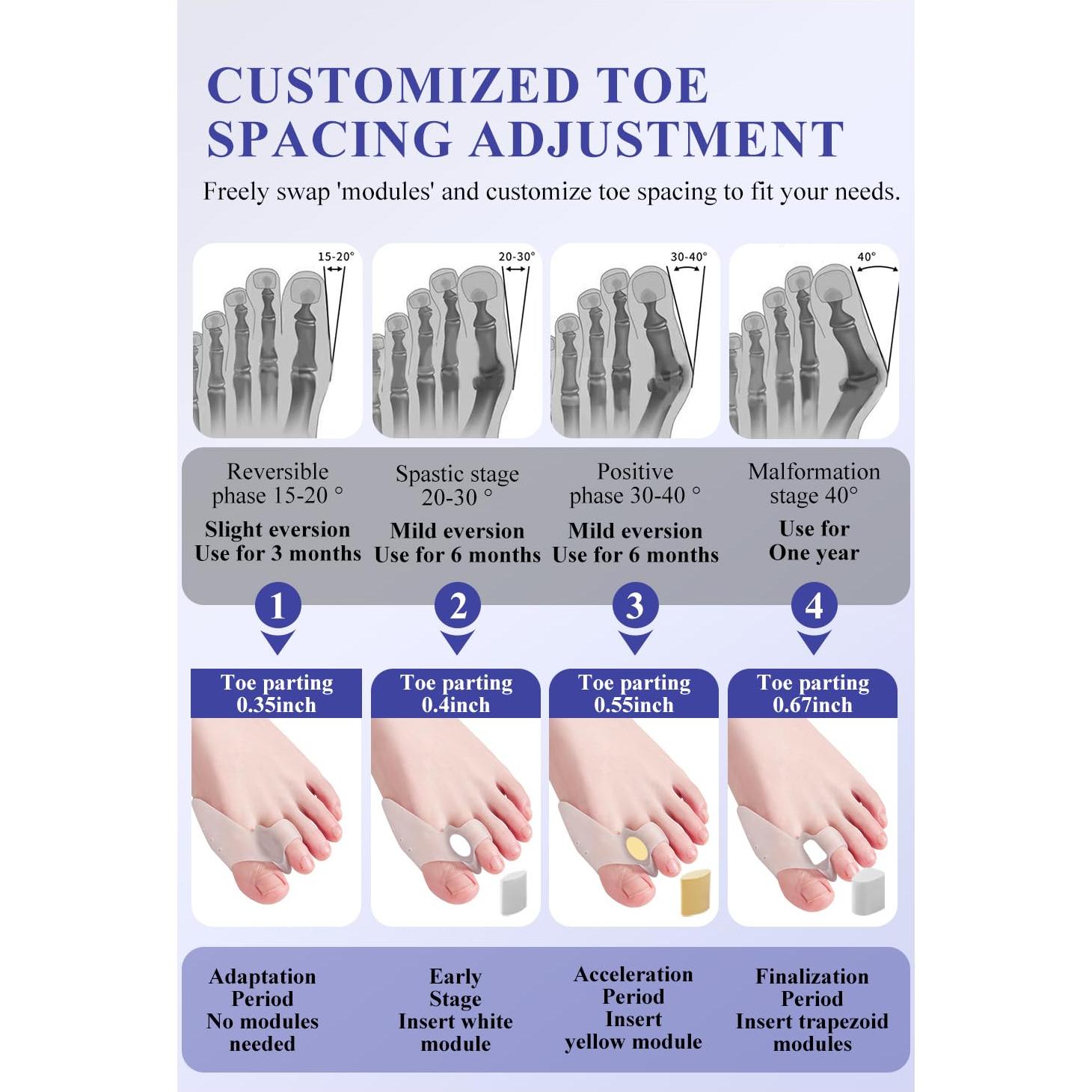 Corrector de Juanetes HEWAOMM Ajustable para Alivio