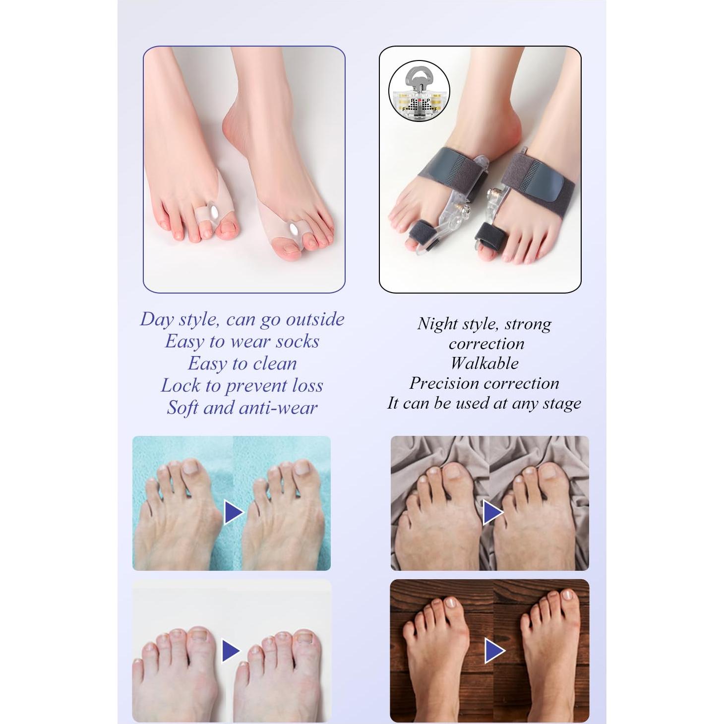 Corrector de Juanetes HEWAOMM Ajustable para Alivio