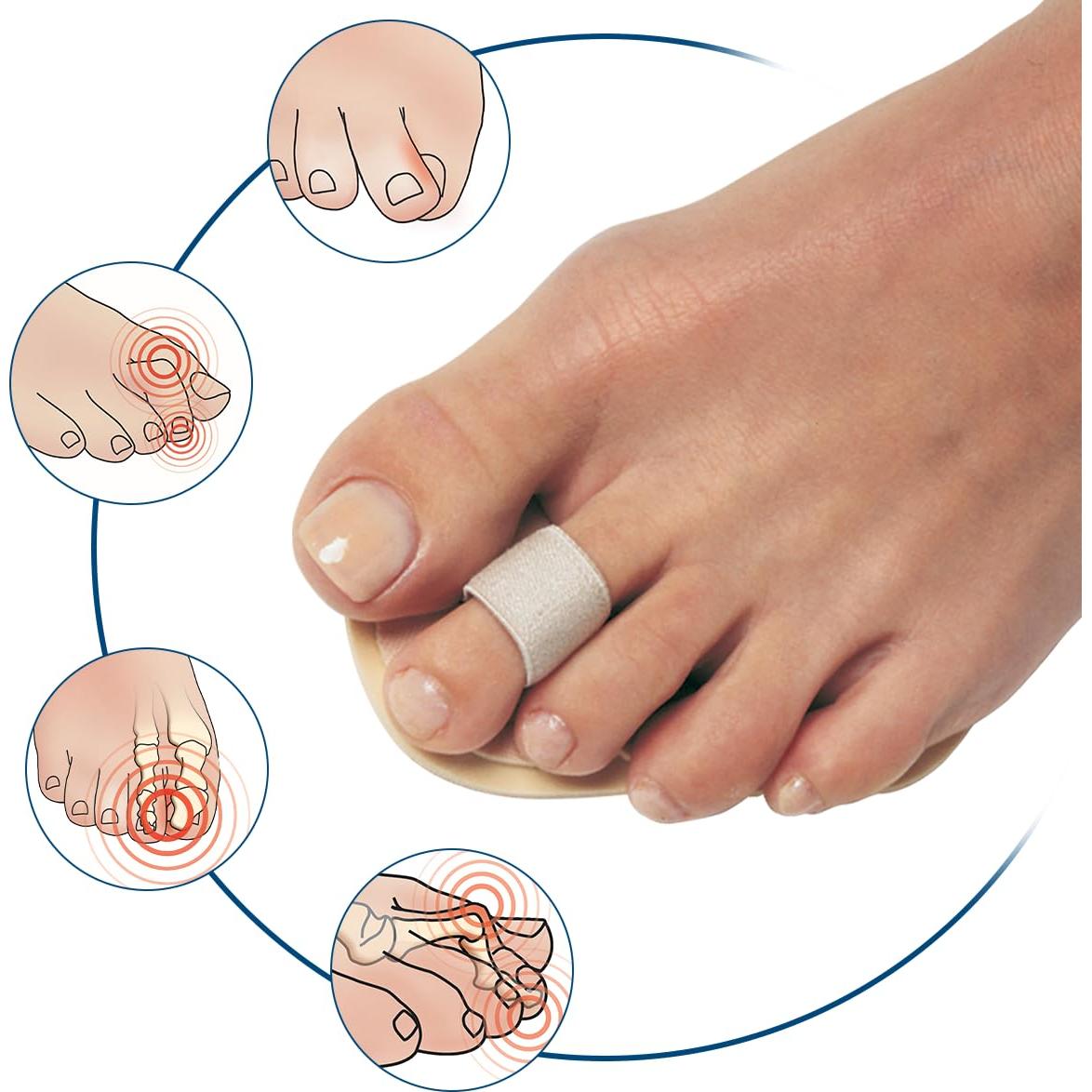 Enderezador de Dedos PediFix - Paquete de 3 Alineadores