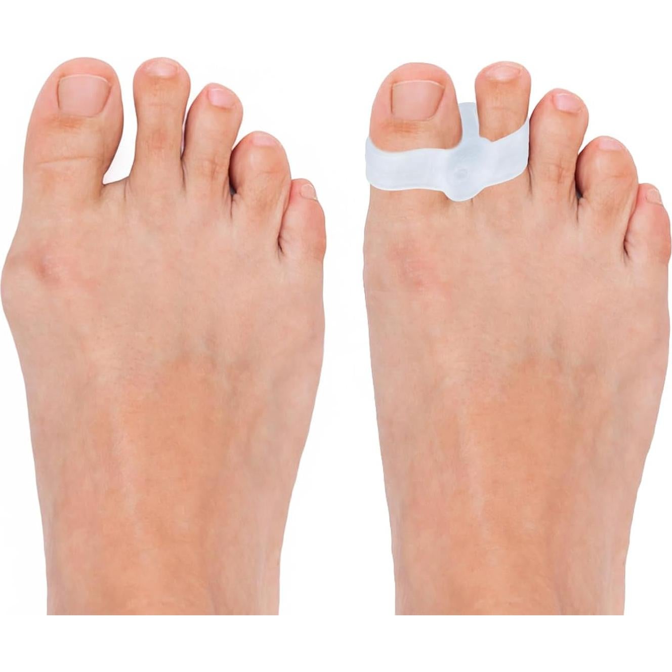 Separadores de Dedos de Silicona 12 Piezas Lasuroa 5x1.4cm