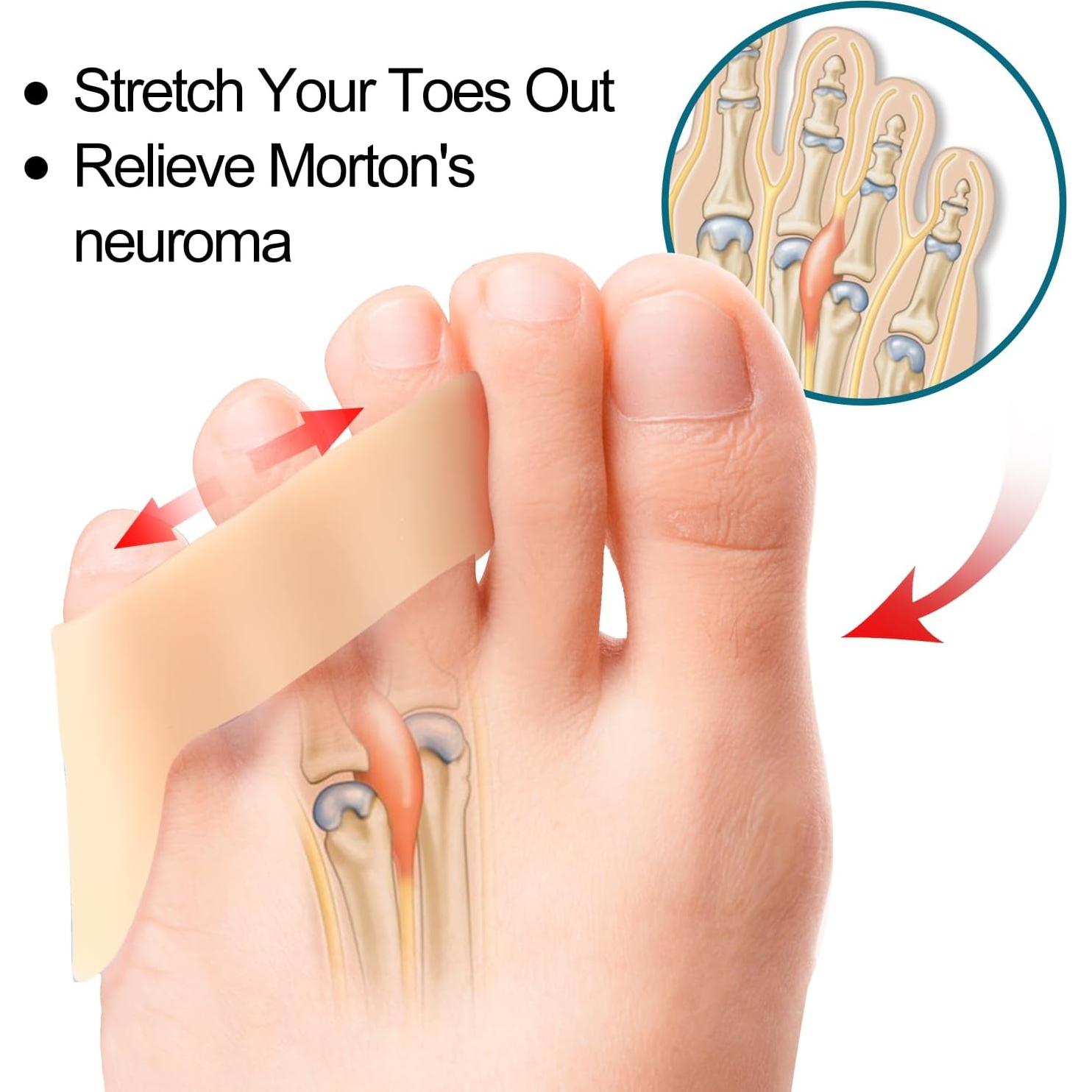 Separadores de Dedo Meñique Povihome - Alivio Neuroma 10 Piezas