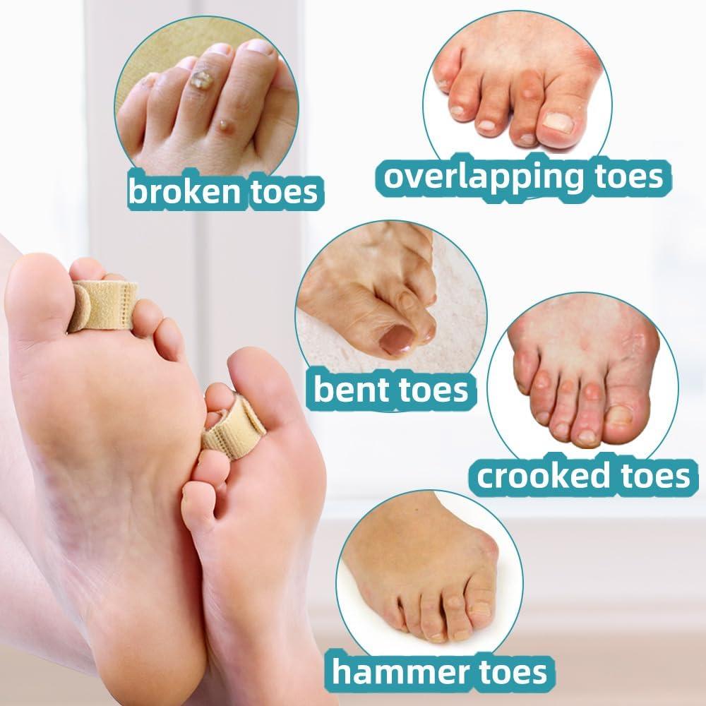 Separadores de Dedos Reutilizables Meidland Beige para Alineación