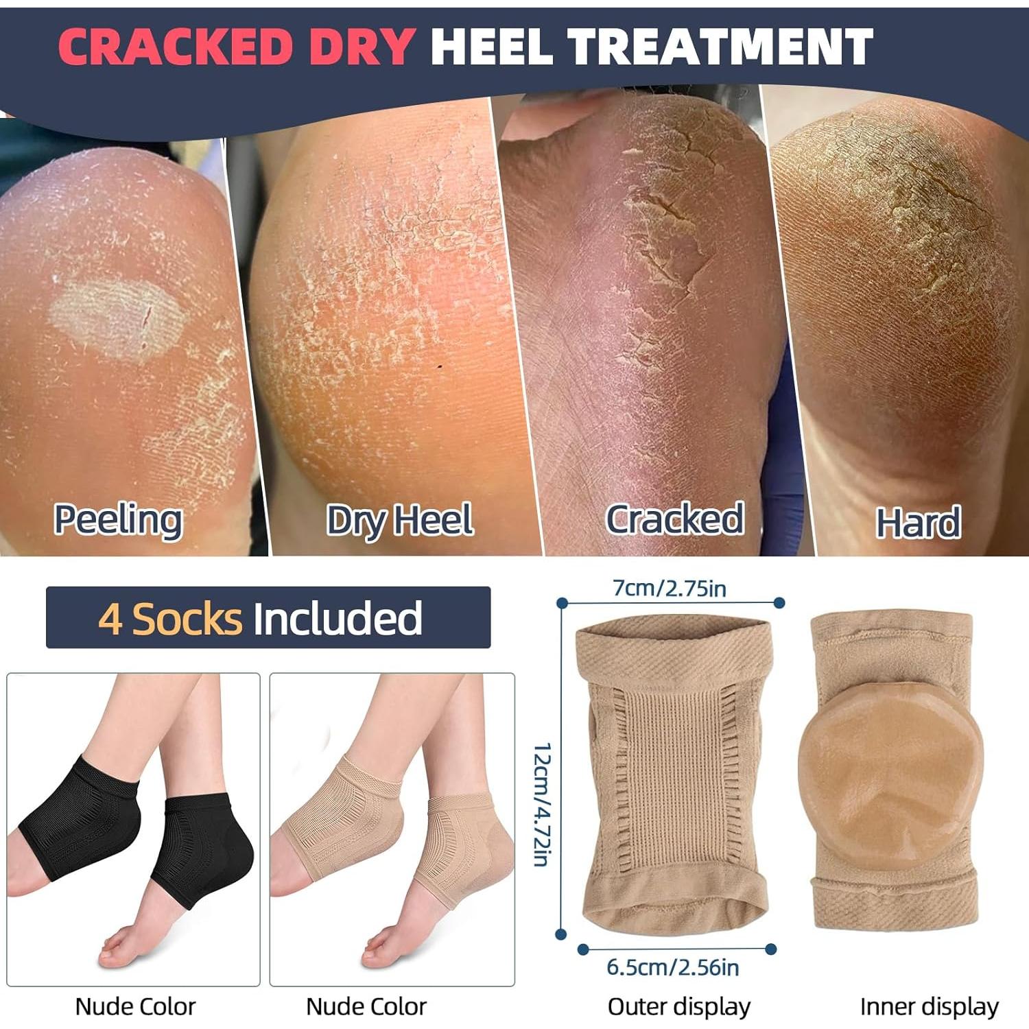 Calcetines Hidratantes para Talones Agrietados Mickee - 2 Pares