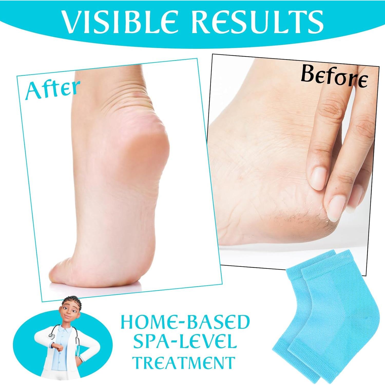 Calcetines hidratantes de talón YUXIANLB - 2 pares