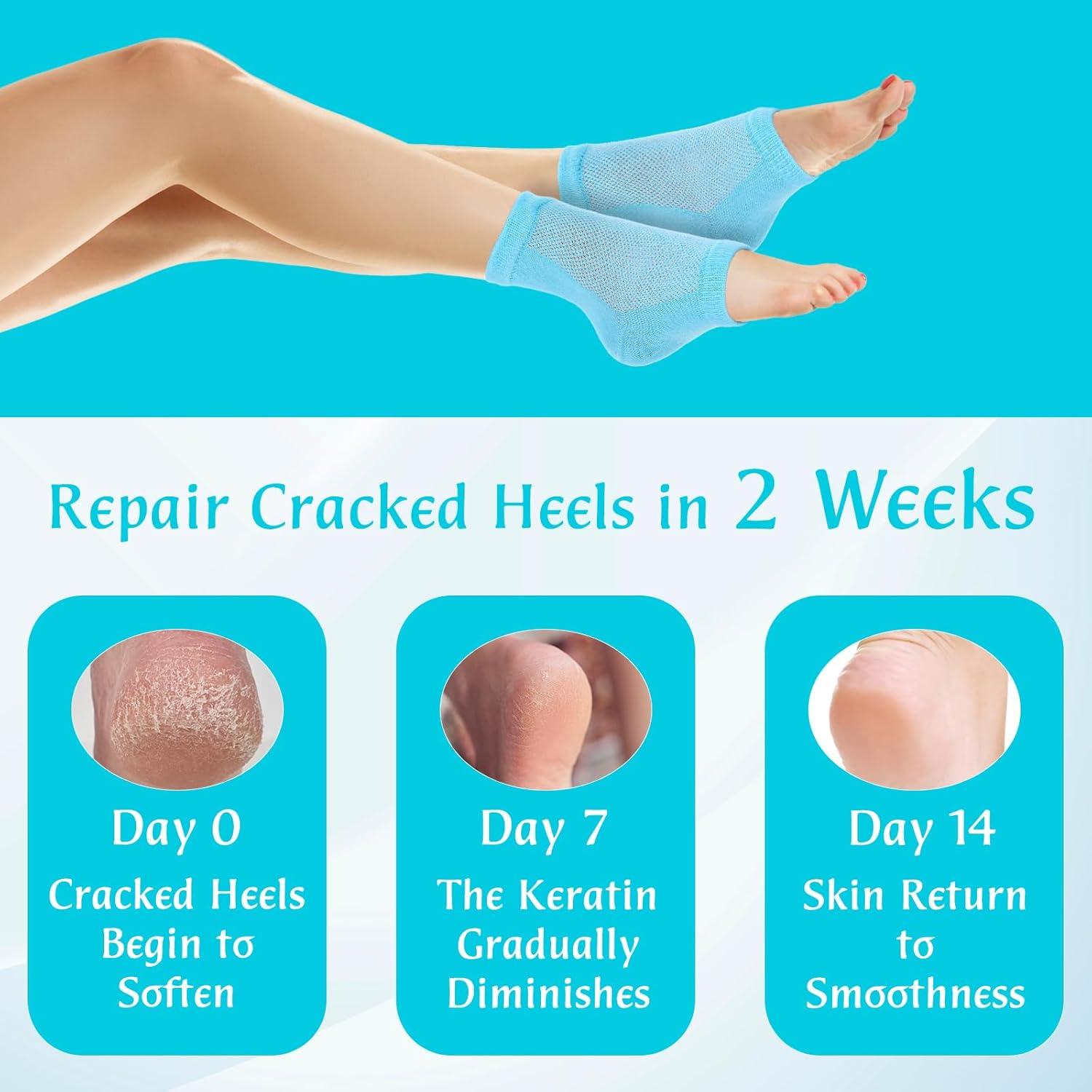 Calcetines hidratantes de talón YUXIANLB - 2 pares