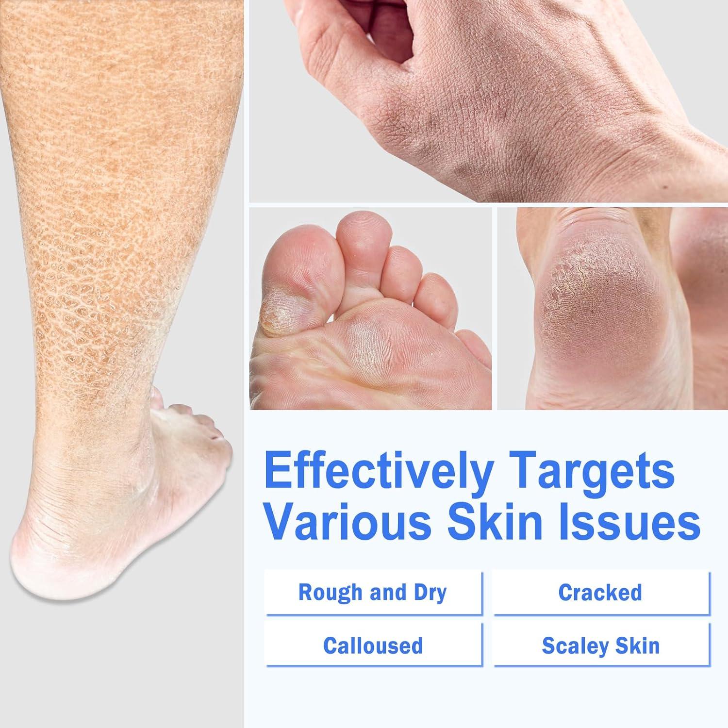 Crema para Pies Ultra Hidratante TEAWOO 150g con Calcetines