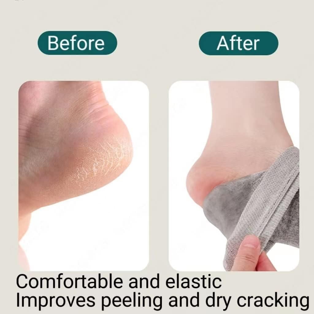 8 Pares de Calcetines Hidratantes Sin Dedos YSAFAI para Pies Secos