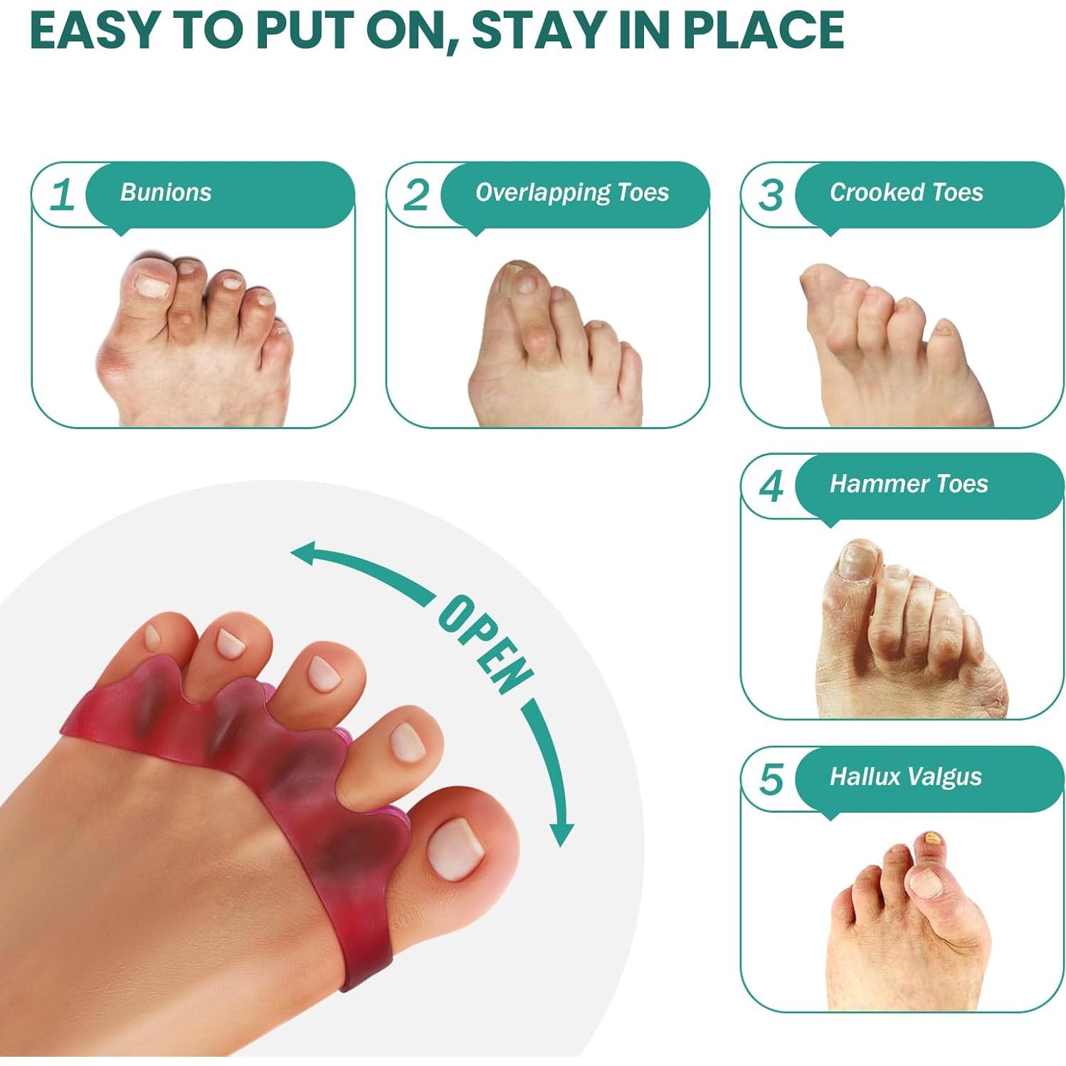 Separador de Dedos Welnove - 8 Piezas Gel para Juanetes y Dedos en Martillo