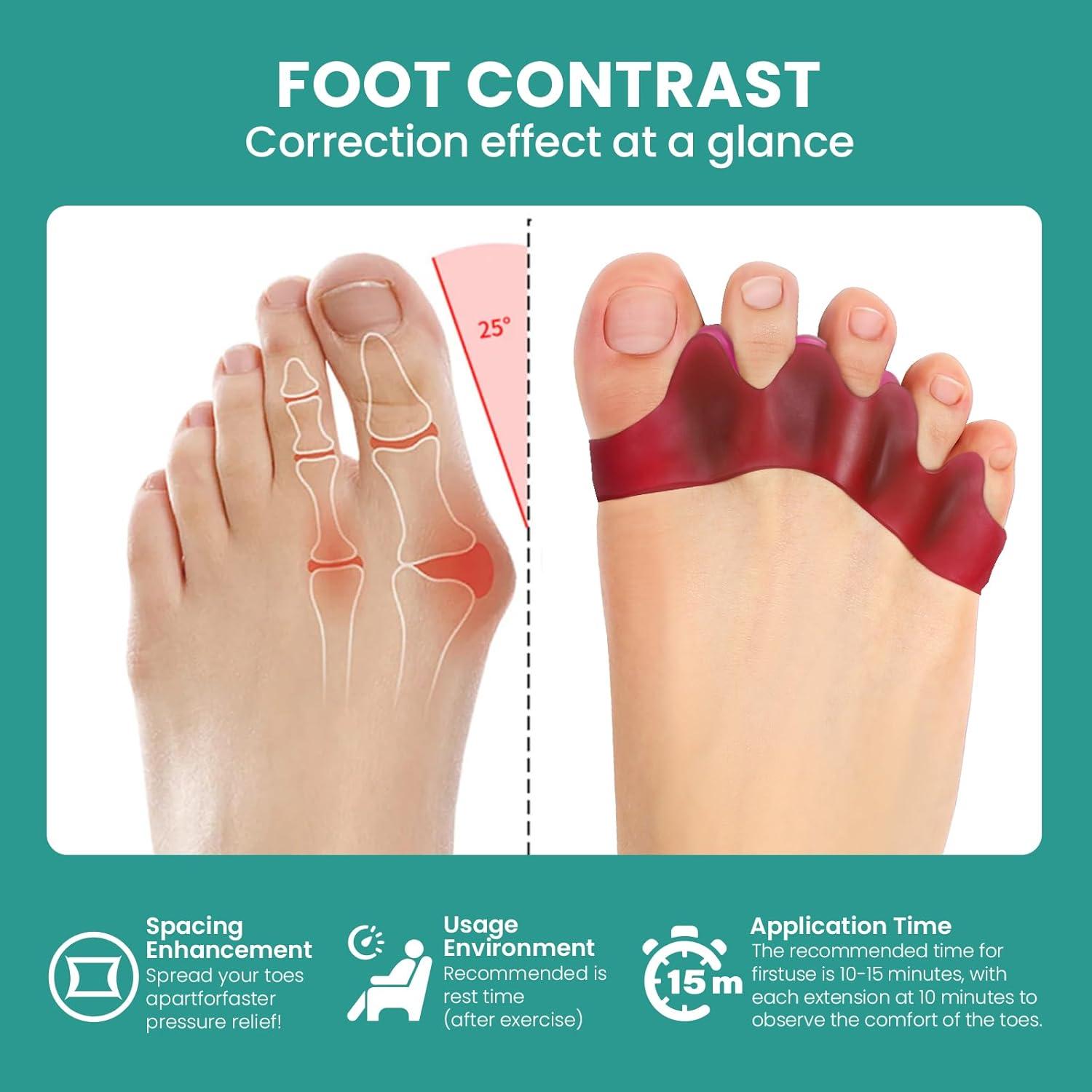 Separador de Dedos Welnove - 8 Piezas Gel para Juanetes y Dedos en Martillo