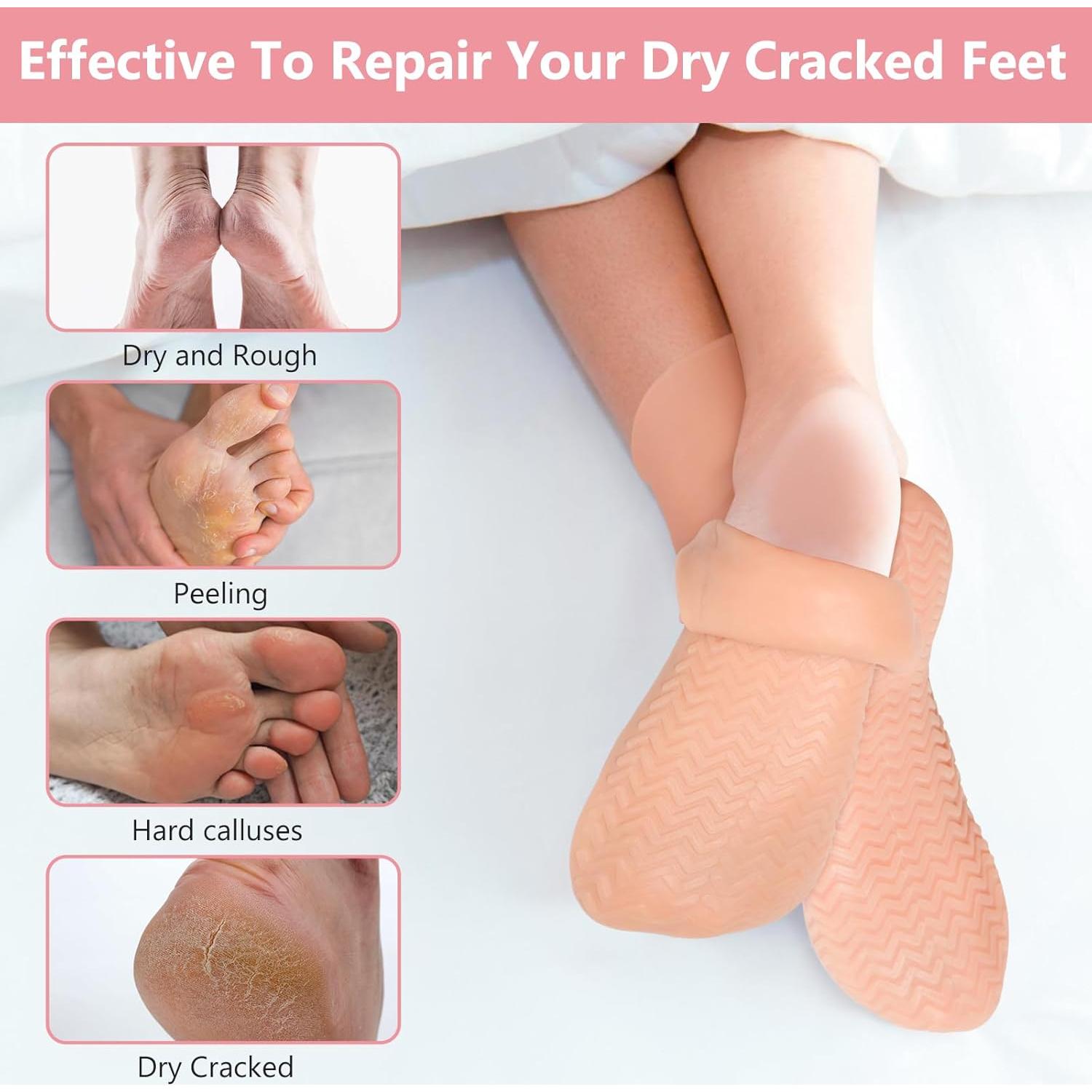 Calcetines Hidratantes de Silicona Vigdit XL Antideslizantes - 2 Pares