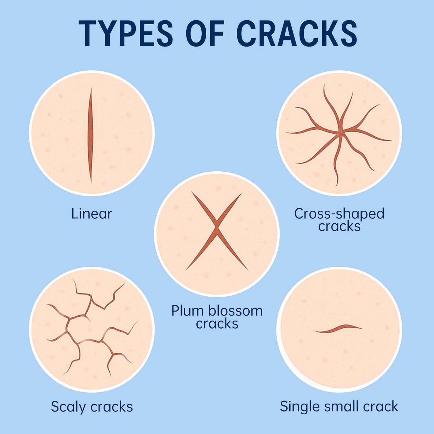 Parche Hidratante para Talones Secos PUREEASE - 6 Parches