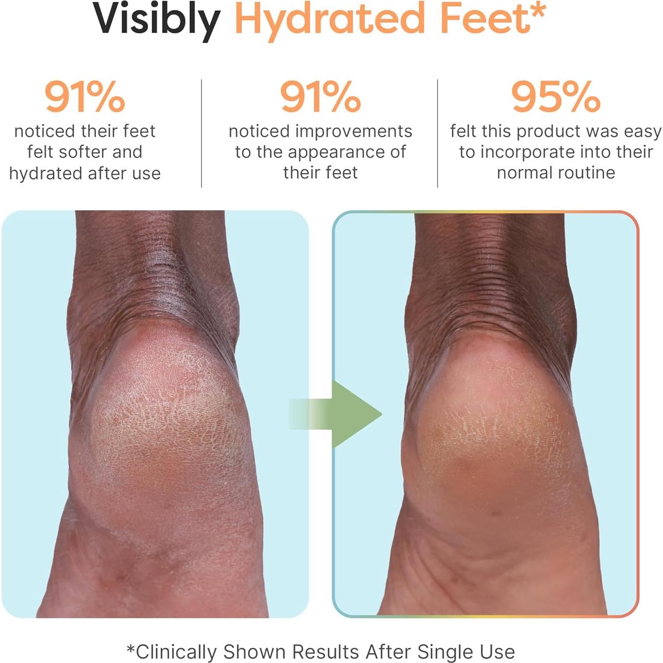 Máscara Hidratante para Pies ZenToes - 3 Pares, Aroma Vainilla