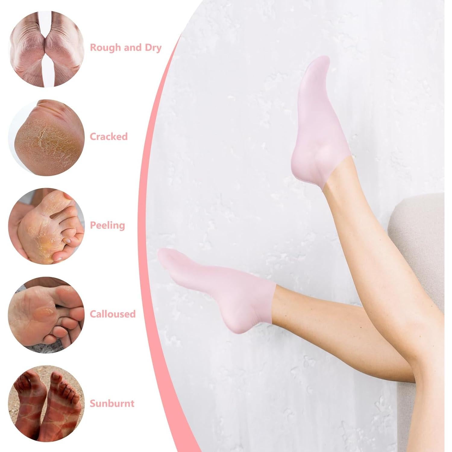 Calcetines Hidratantes de Silicona Vigdit - 2 Pares Rosa y Blanco