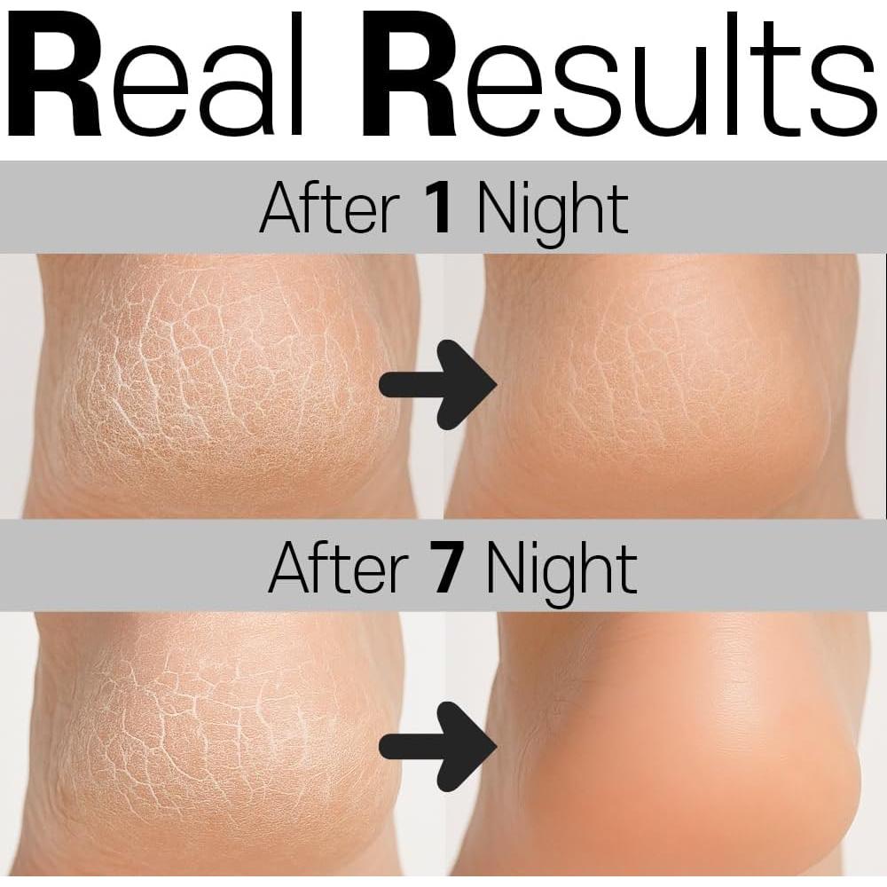 Calcetines Hidratantes HiMedi para Talones Agrietados - 2 Pares