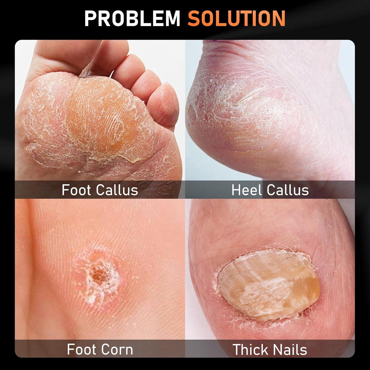 Juego de Pedicura Profesional DRMODE 4 Piezas Acero Inoxidable