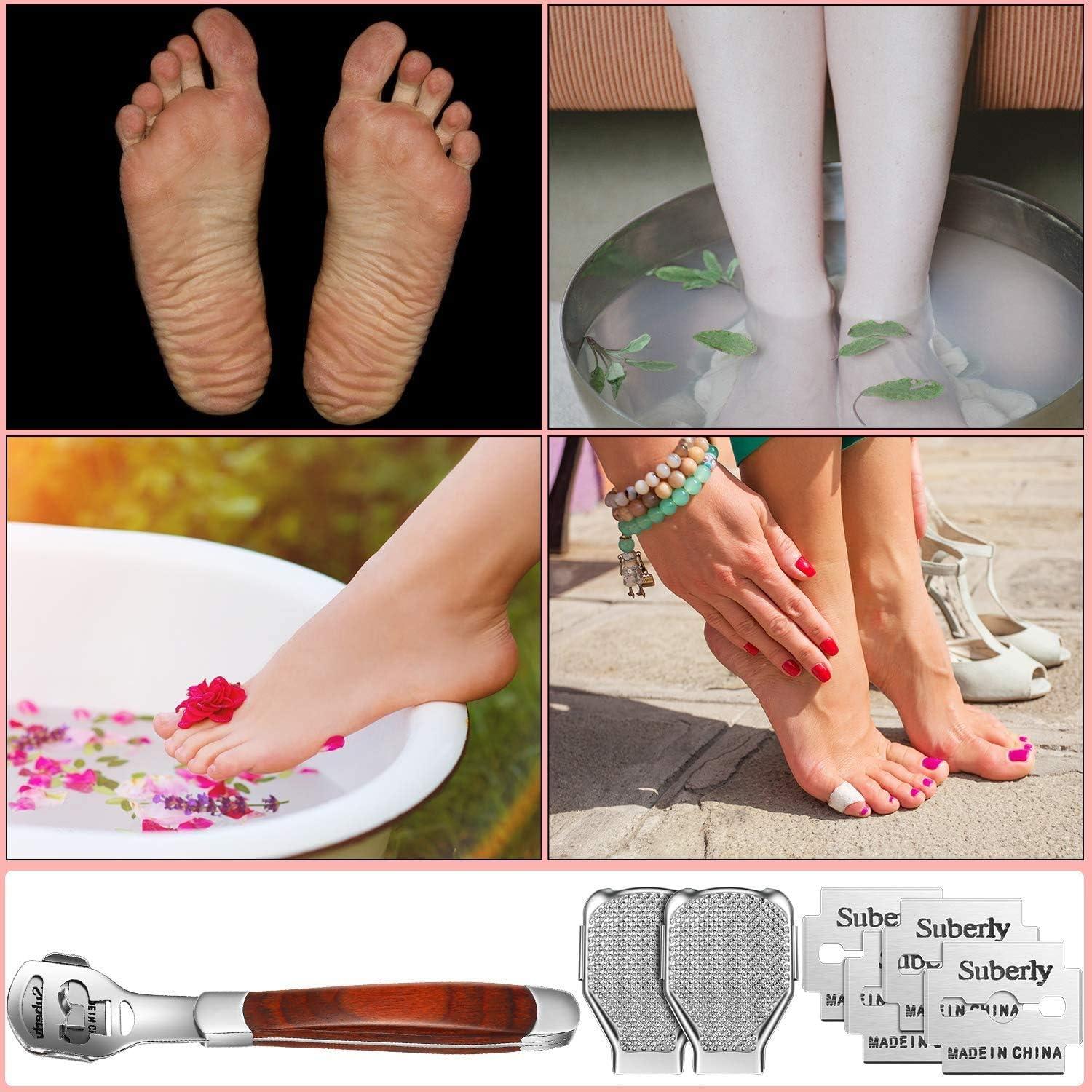 Cortador de Callos YIMART con 10 Cuchillas Acero Inoxidable