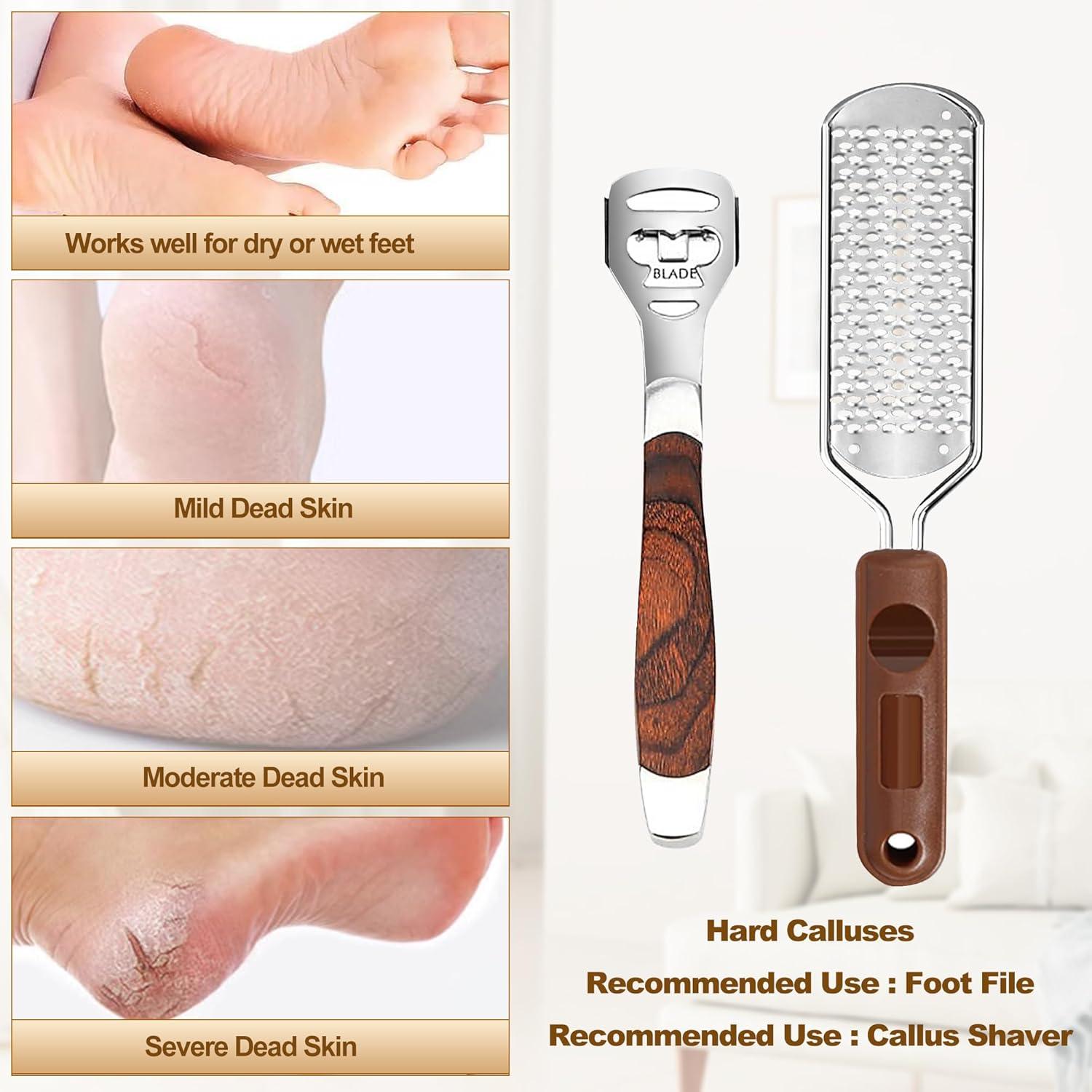 Kit Removedor de Callos para Pies Qneiaym - 53 Piezas