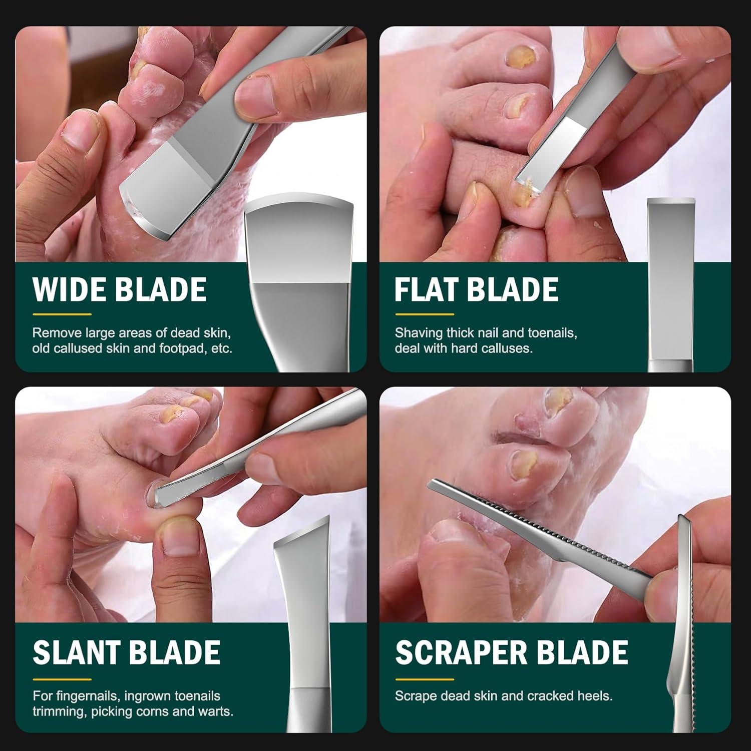 Juego de Cuchillos de Pedicura FVION - Kit 4 Piezas Acero Inoxidable