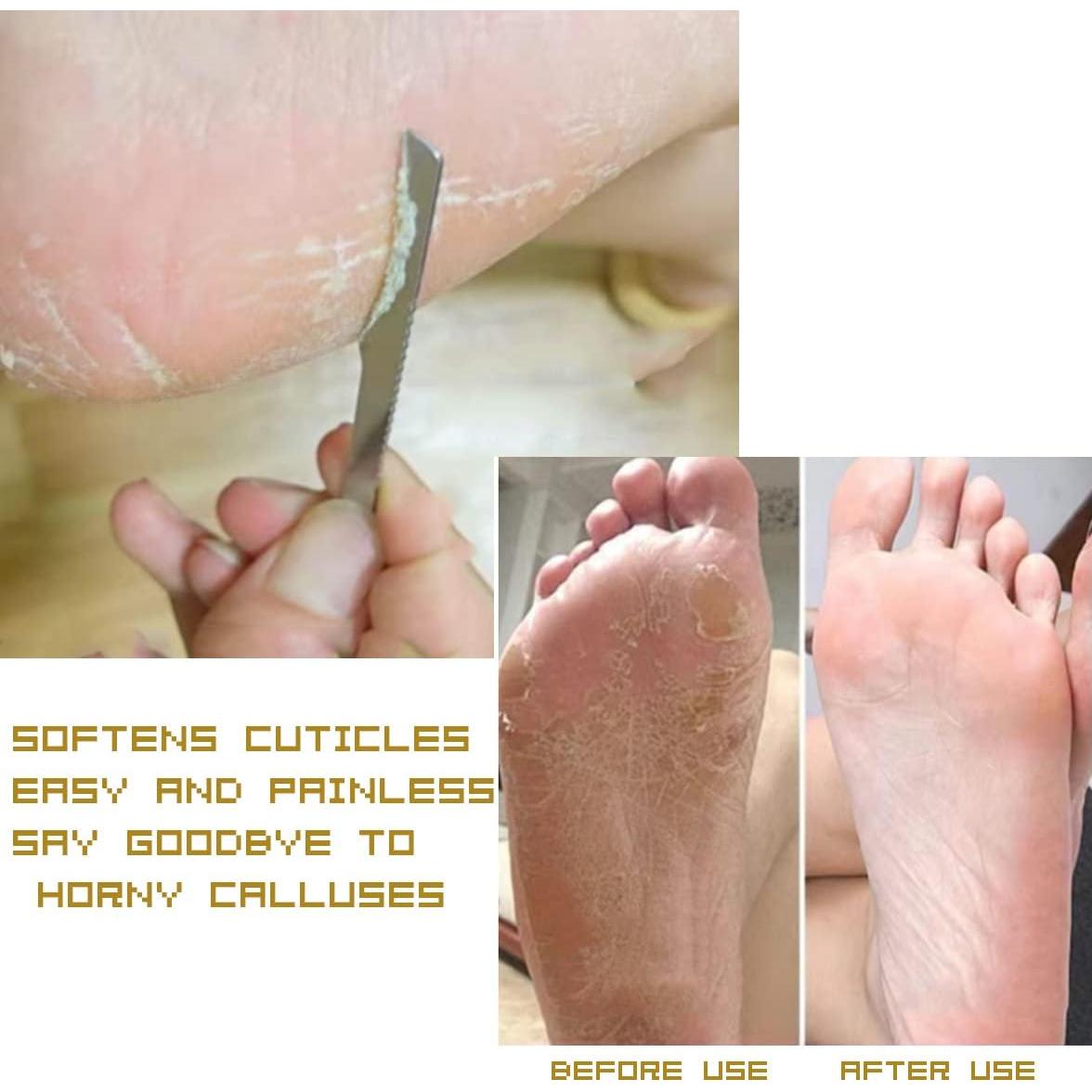 Juego de cuchillos de pedicura WANLIAN 3 piezas acero inoxidable