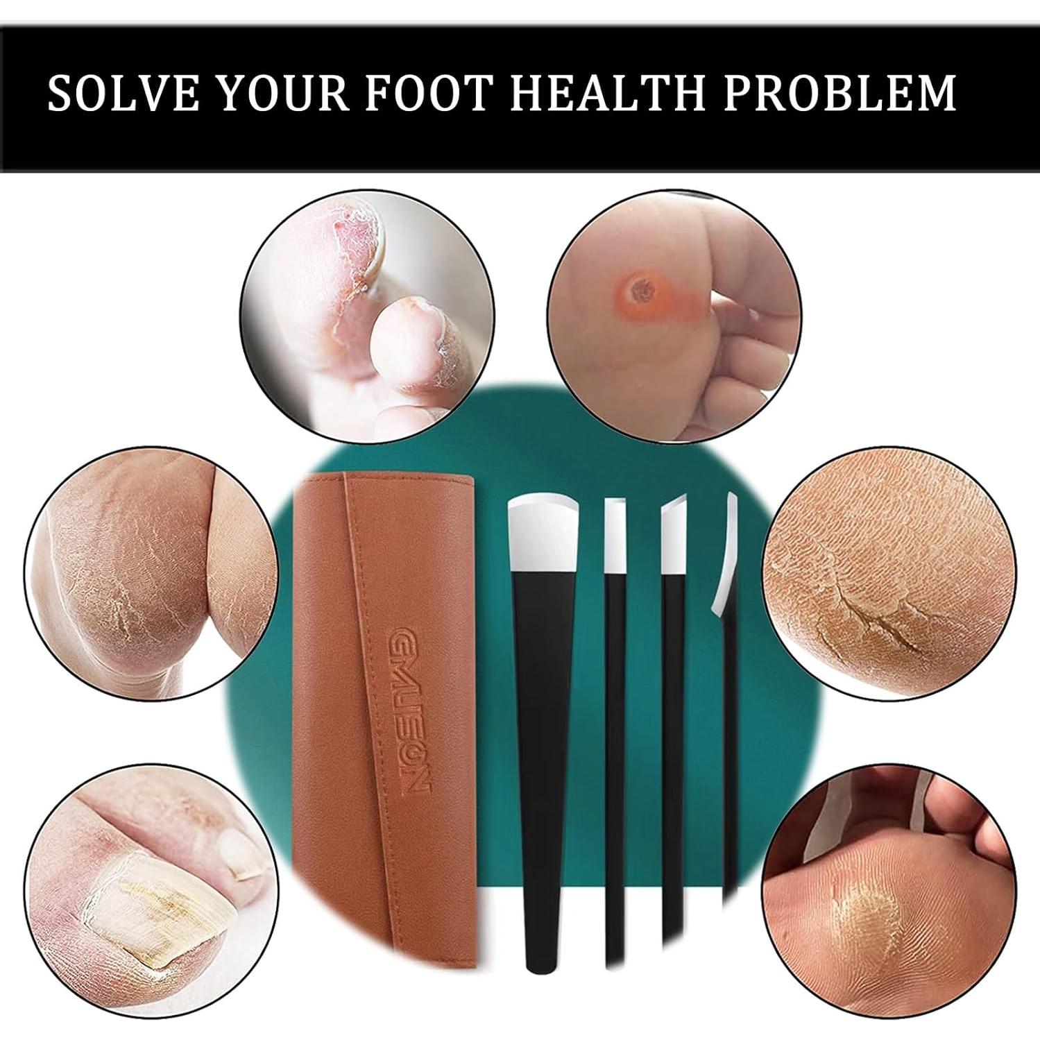 Juego de Cuchillos de Pedicura Profesional Fuwddy 4 Piezas