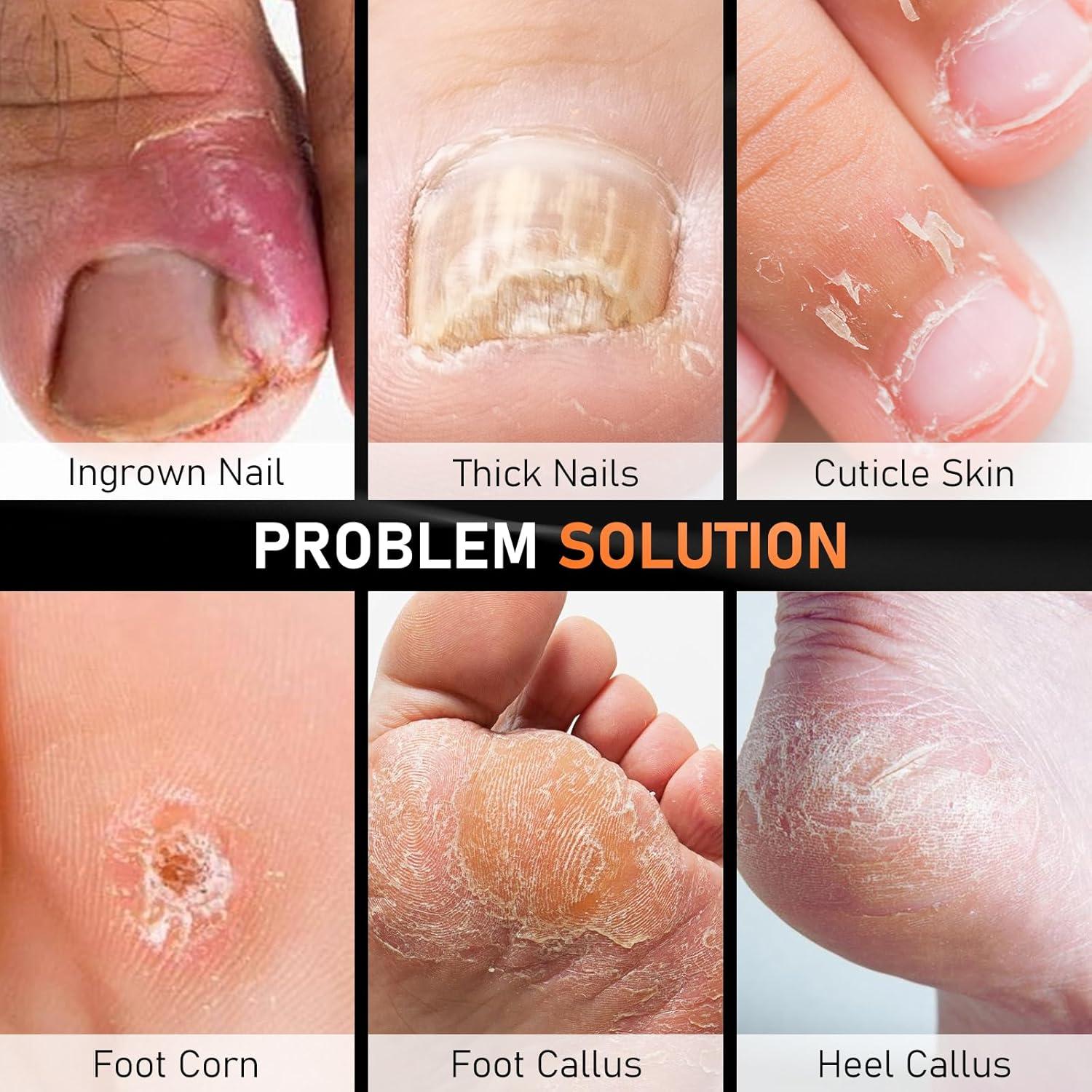 Kit de Pedicura Profesional 7 Piezas DRMODE - Cortauñas y Cuchillos