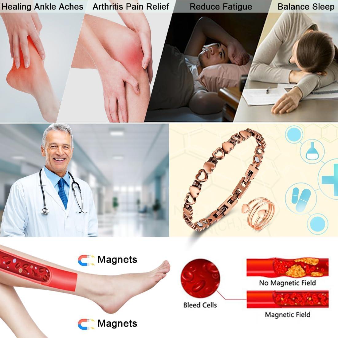 Tobillera Magnética de Cobre Vicmag para Mujeres Ajustable