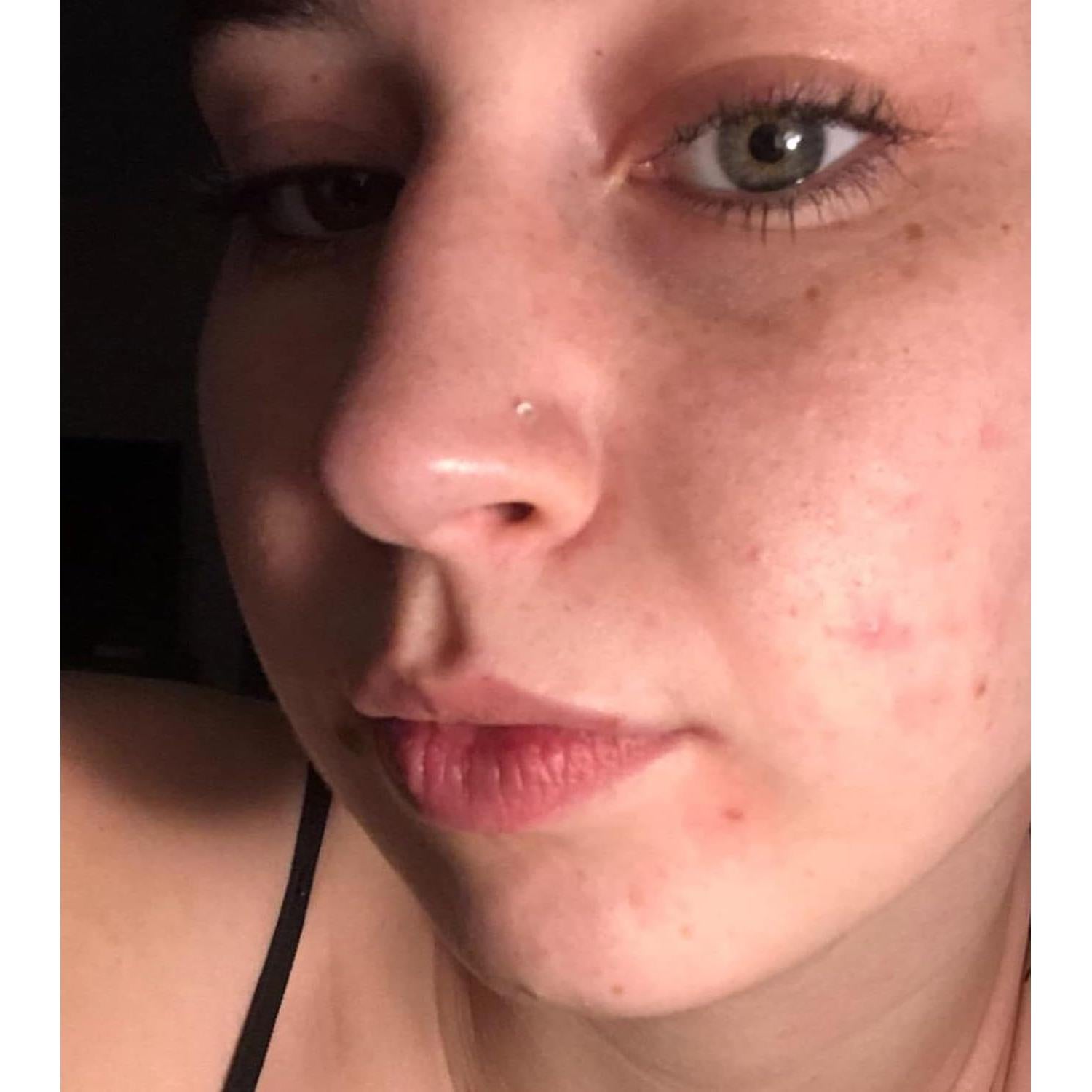 Anillos de Nariz Transparentes QWALIT 18g 20g Retenedores Hipoalergénicos