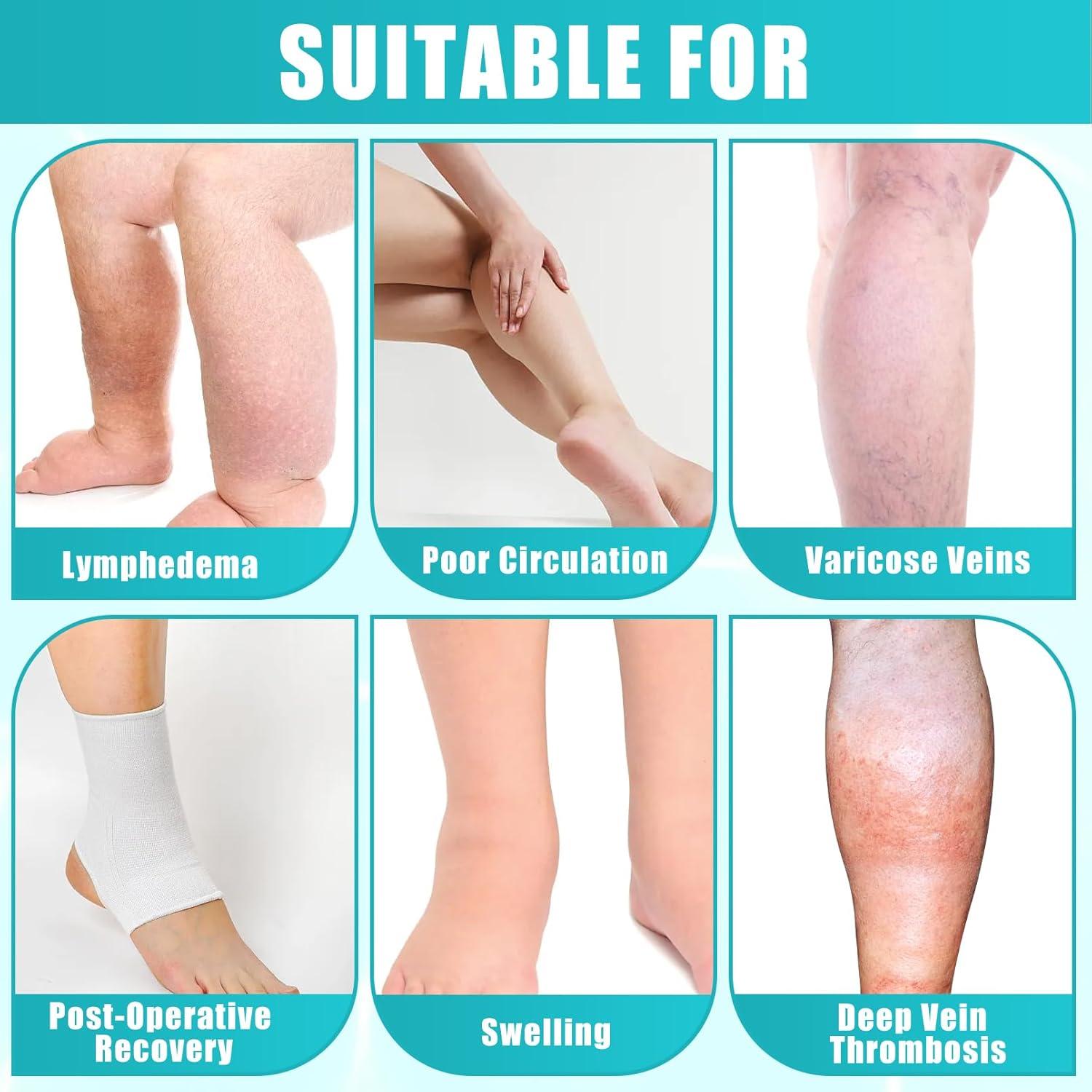 4 Pares de Medias de Compresión CACASO Punta Abierta 15-20 mmHg